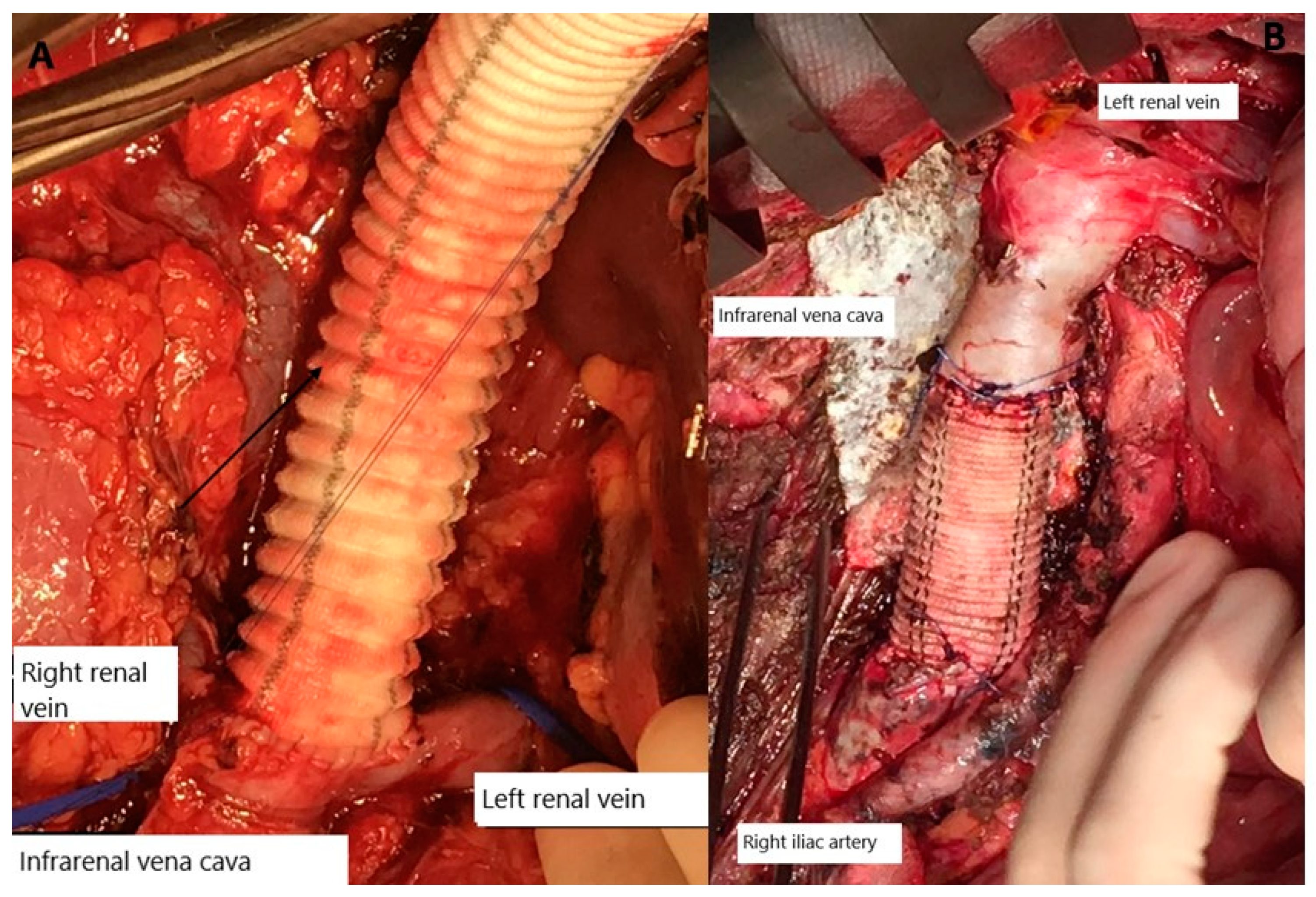 Gastroent 15 00060 g002 Gastroent 15 00060 g002