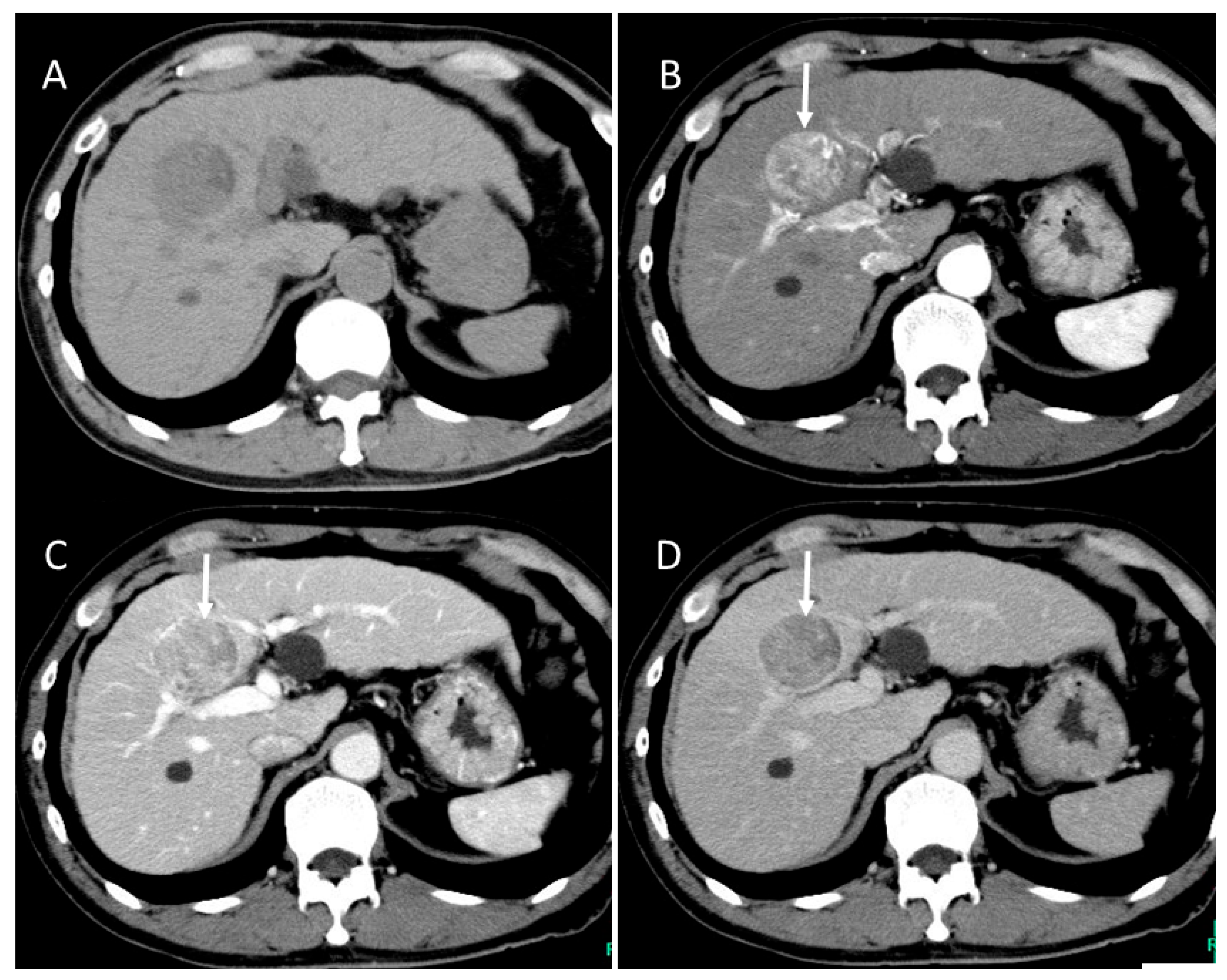 Gastroent 15 00068 g001