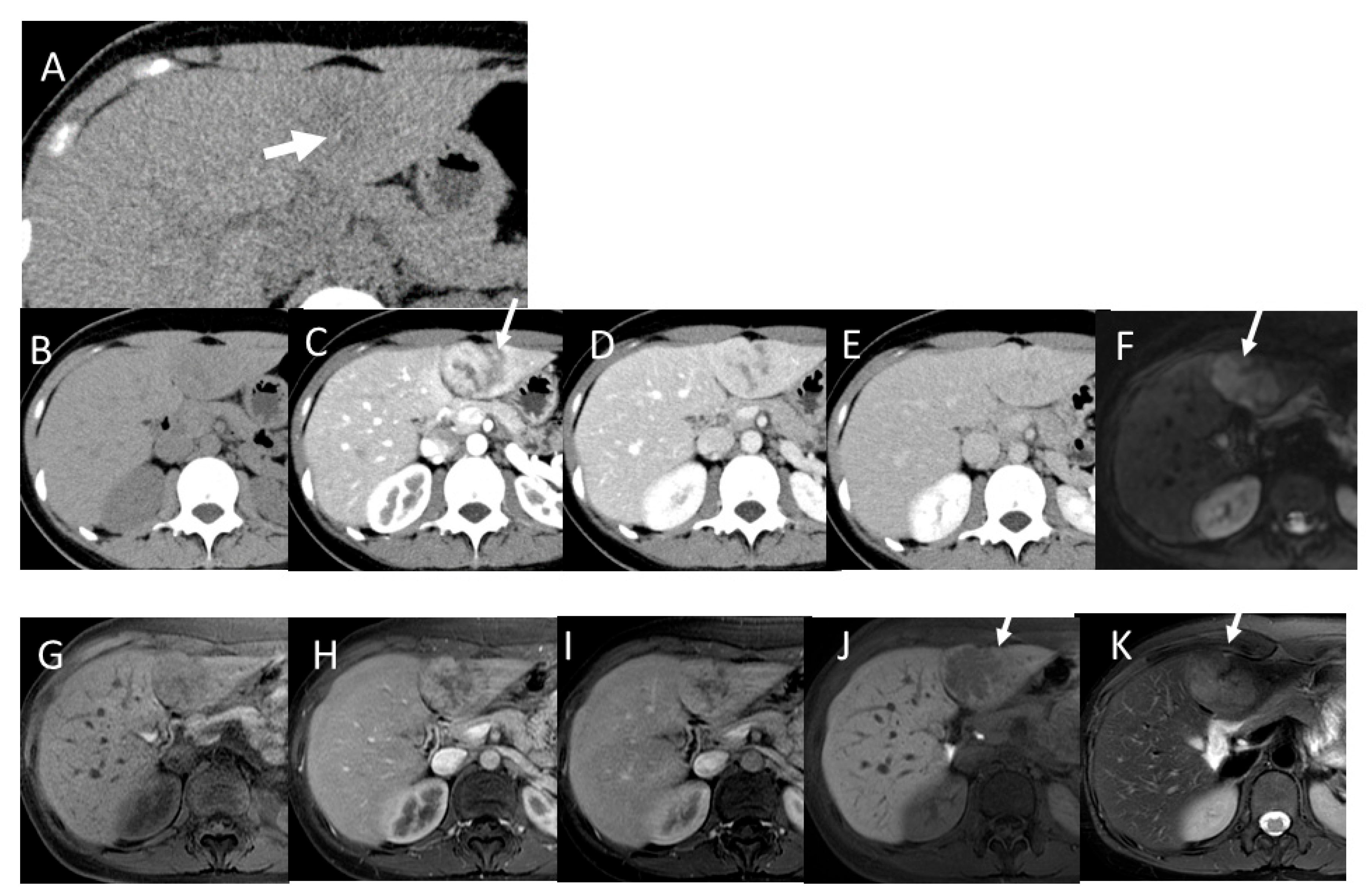 Gastroent 15 00068 g014