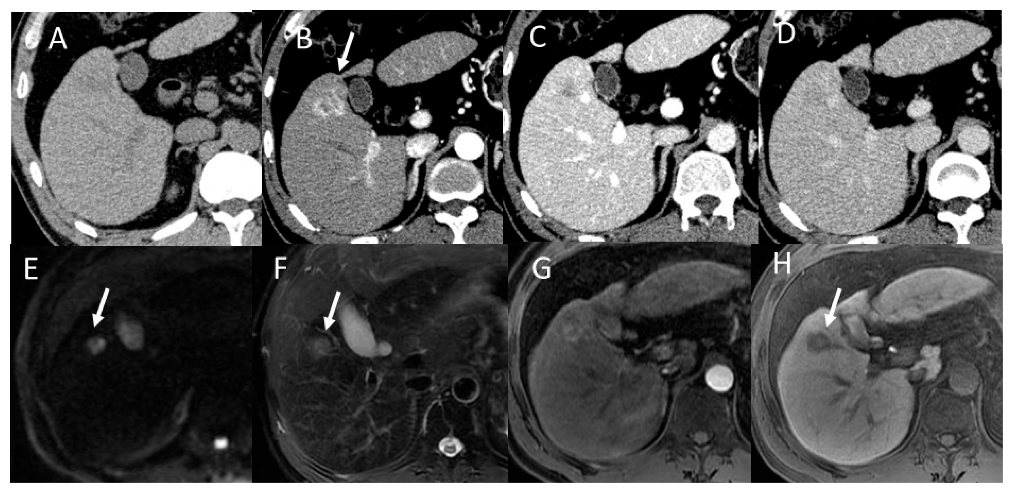 Gastroent 15 00068 g015