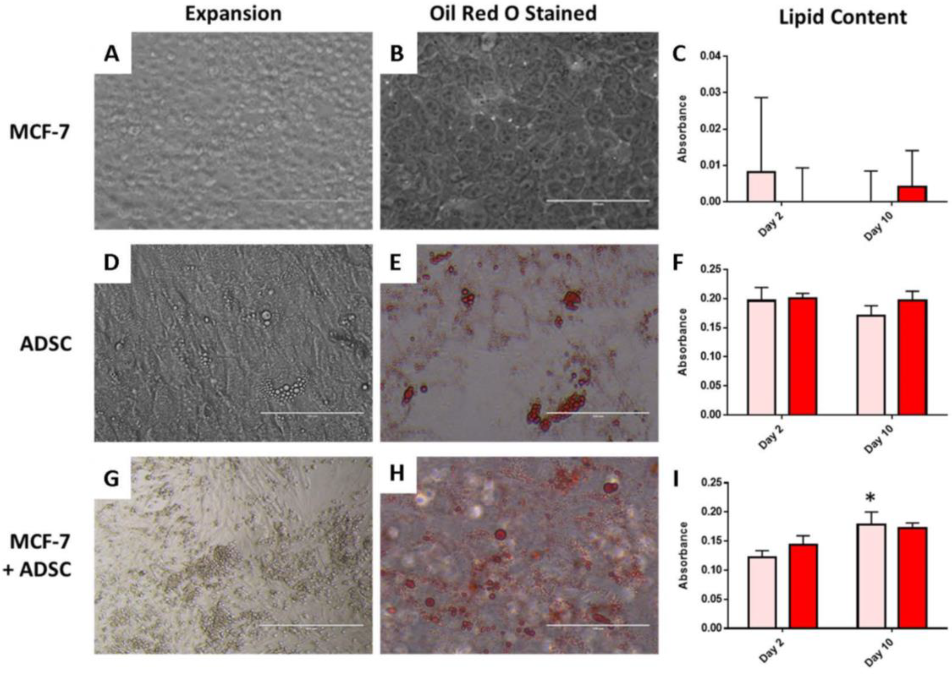 Gels Free Full Text Bioprinted Three Dimensional Cell Laden Hydrogels To Evaluate Adipocyte Breast Cancer Cell Interactions Html