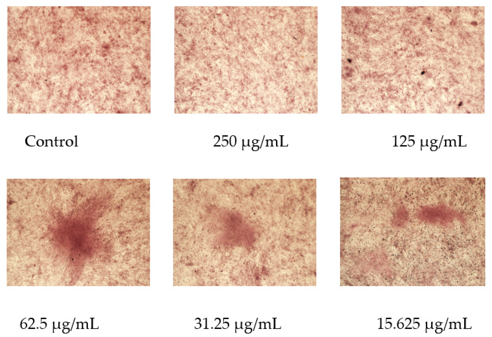 Gels 08 00659 g011 Gels 08 00659 g011