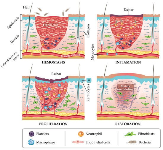 Gels | Free Full-Text | Synthesis of Hydrogels and Their Progress in ...