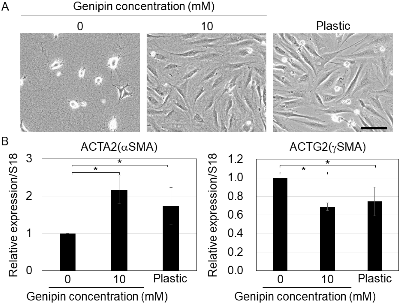 Gels | Free Full-Text | Stiffness-Modulation of Collagen Gels by  Genipin-Crosslinking for Cell Culture