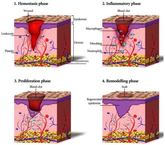 Gels | Free Full-Text | Aloe vera-Based Hydrogels for Wound Healing ...