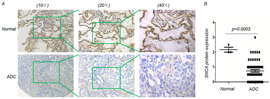 Genes | Free Full-Text | SNCA Is a Functionally Low-Expressed Gene in ...