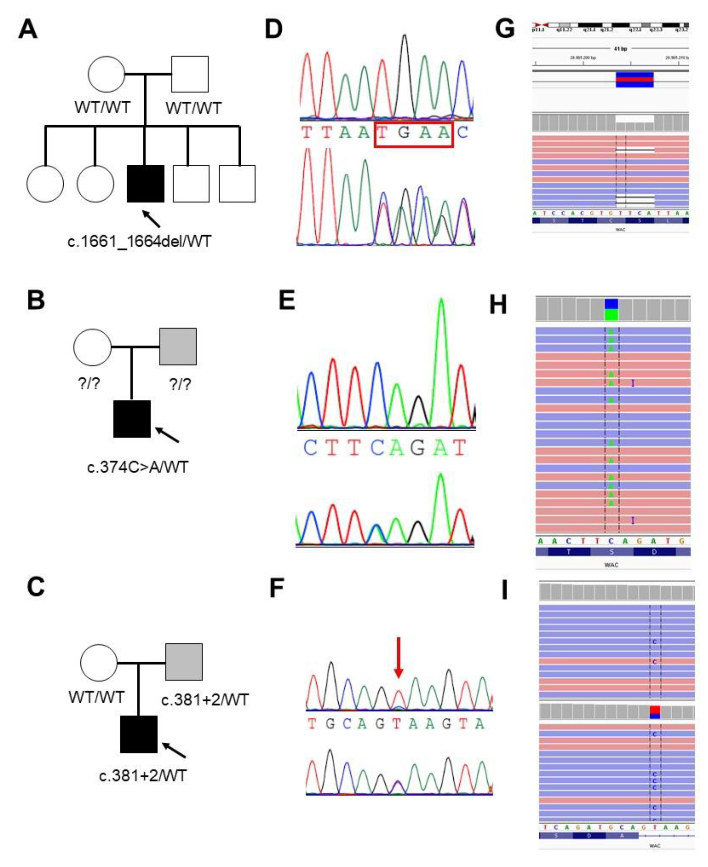 A mosaic maternal splice donor mutation in the EHMT1 gene leads to aberrant  transcripts and to Kleefstra syndrome in the offspring