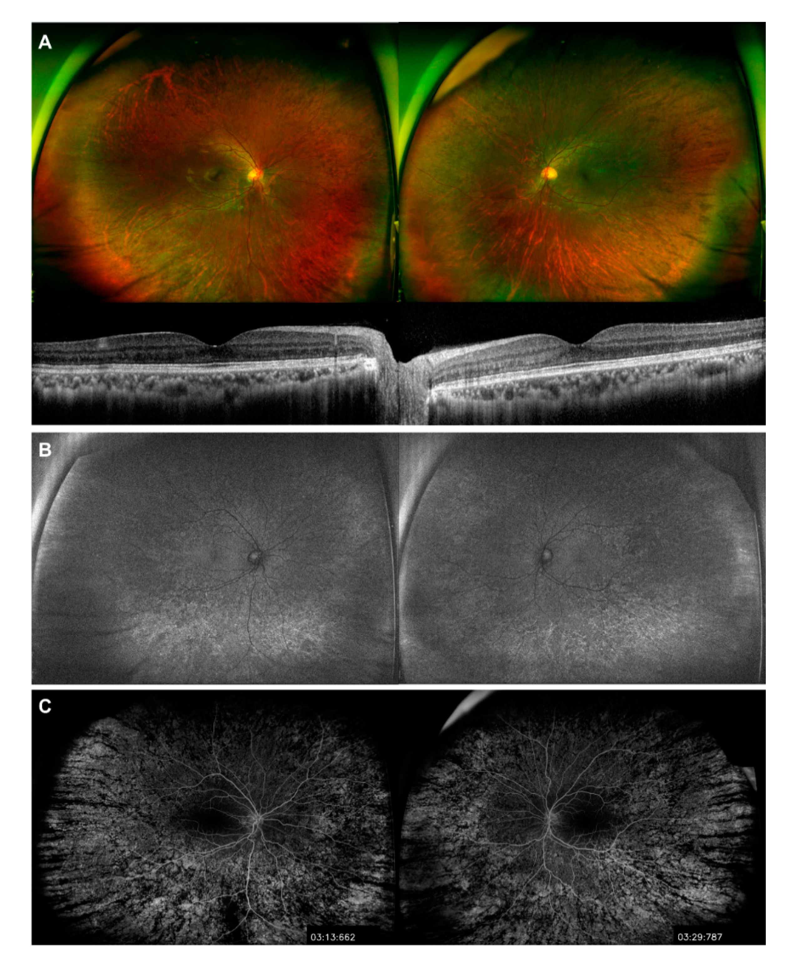 DAILY RETINA SPARGIFIAMMA 0082