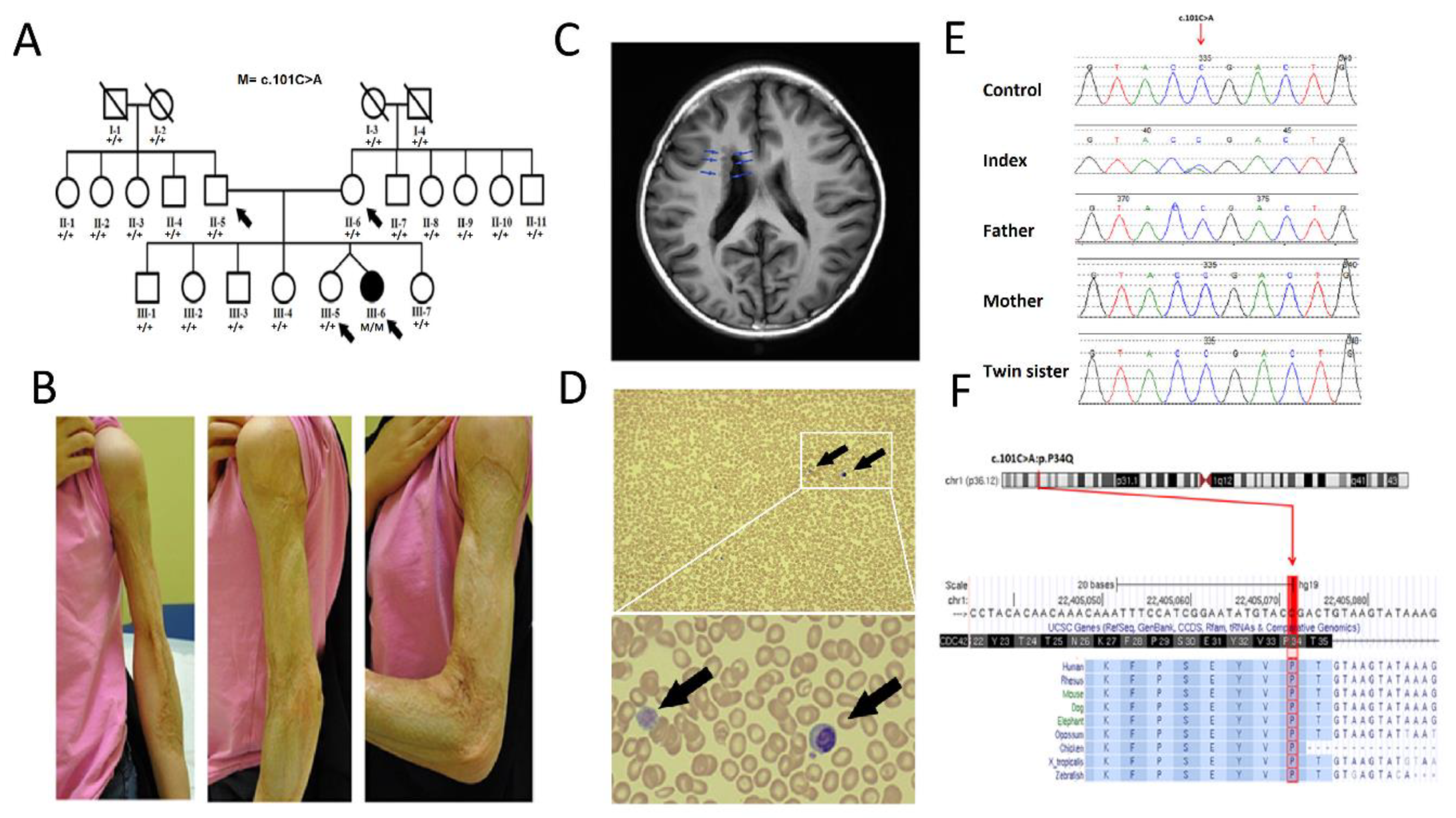 Genes 12 00294 g001