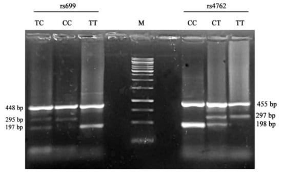 Genes | Free Full-Text | Angiotensinogen Gene Missense Polymorphisms ...