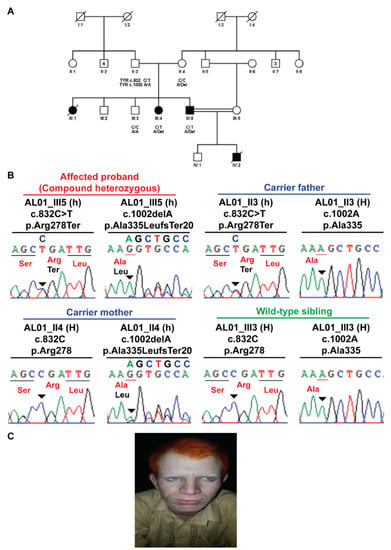 Genes, Free Full-Text