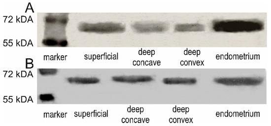 Genes | Free Full-Text | Estrogen Receptor Type 1 and Type 2