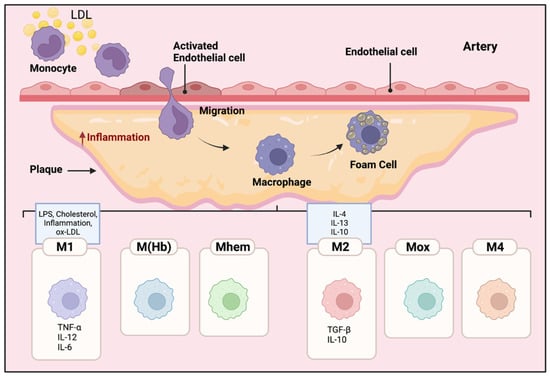 Genes | Free Full-Text | Macrophage Polarization in Atherosclerosis