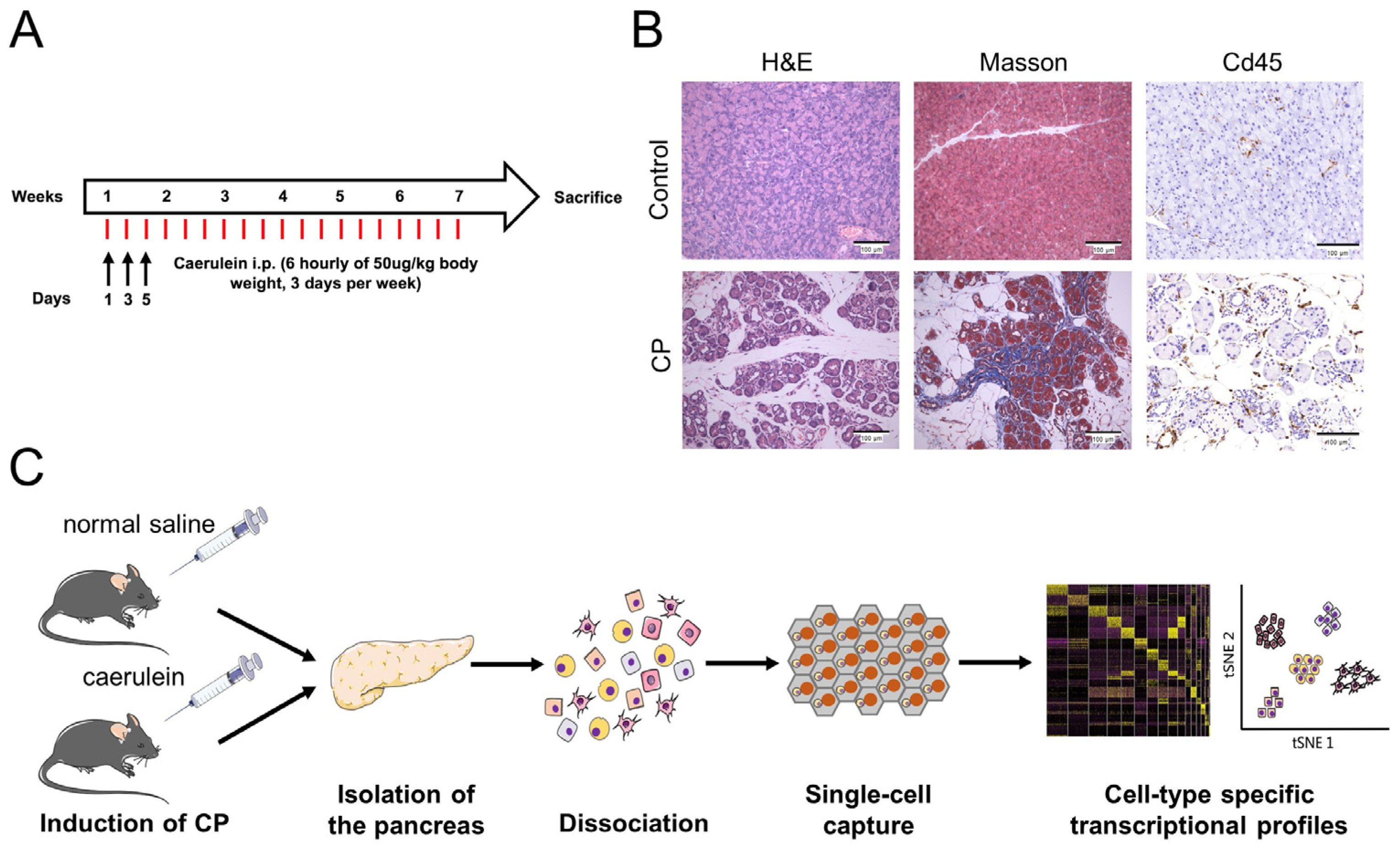 Genes | Free Full-Text | Single-Cell Transcriptomic Analysis of the Mouse  Pancreas: Characteristic Features of Pancreatic Ductal Cells in Chronic  Pancreatitis | HTML