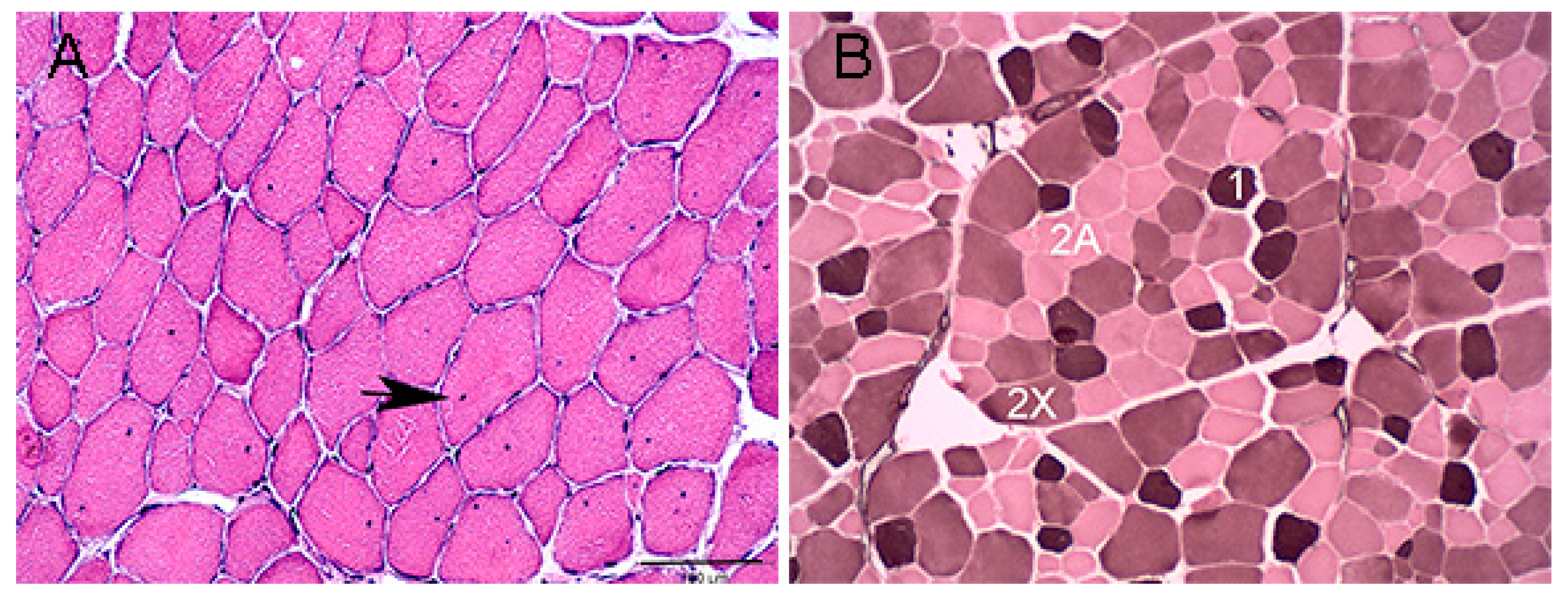 Genes | Free Full-Text | Enriched Pathways of Calcium Regulation,  Cellular/Oxidative Stress, Inflammation, and Cell Proliferation  Characterize Gluteal Muscle of Standardbred Horses between Episodes of  Recurrent Exertional Rhabdomyolysis