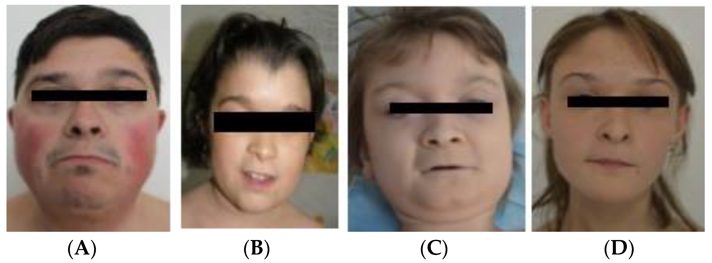 Genes 14 00465 g004 Genes 14 00465 g004