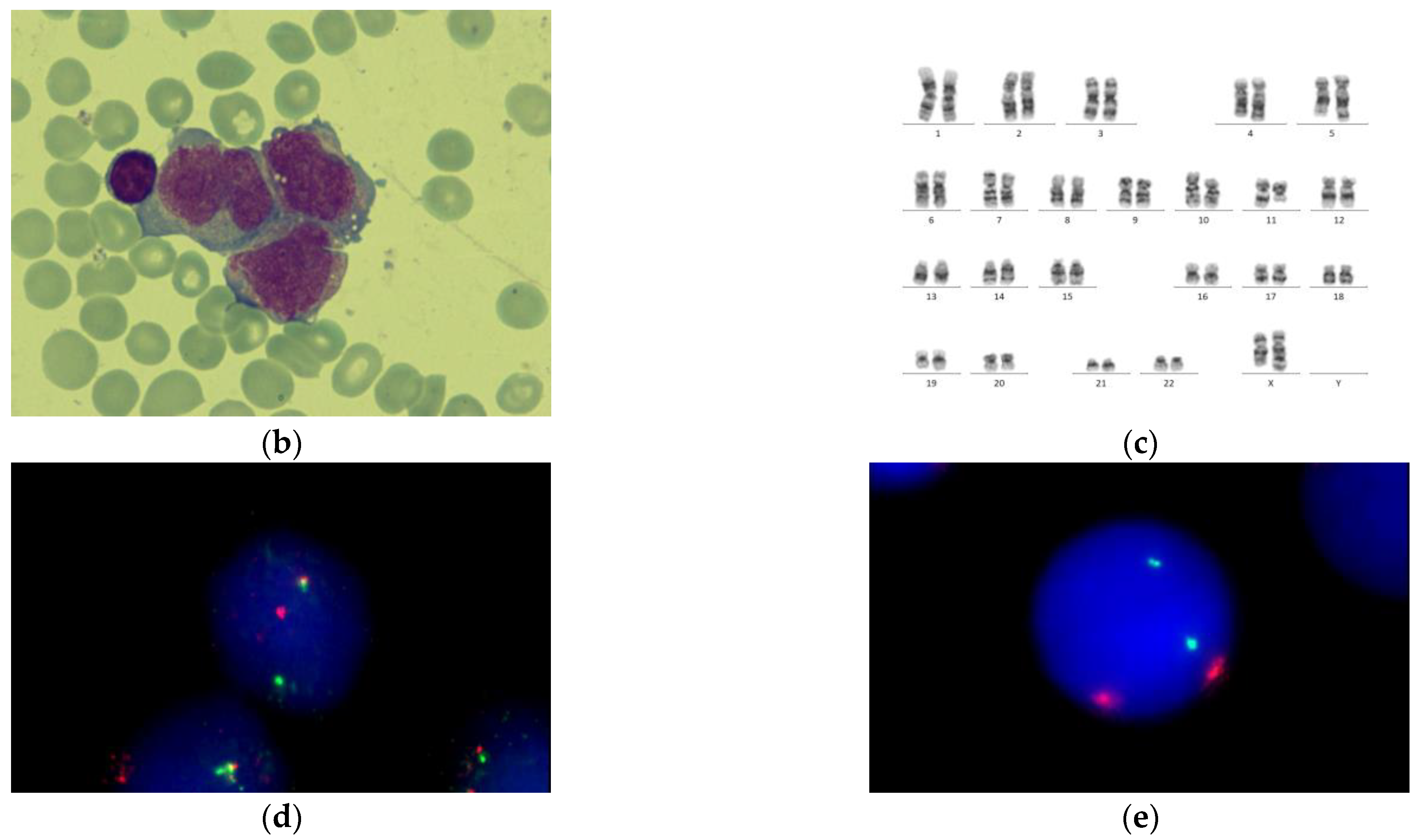 Genes 14 00675 g002b Genes 14 00675 g002b
