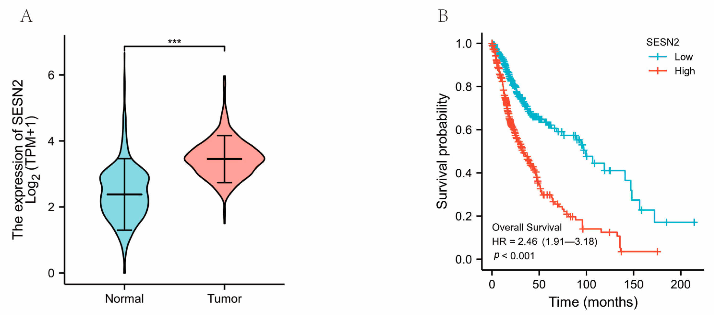 Genes | Free Full-Text | SESN2 Could Be a Potential Marker for