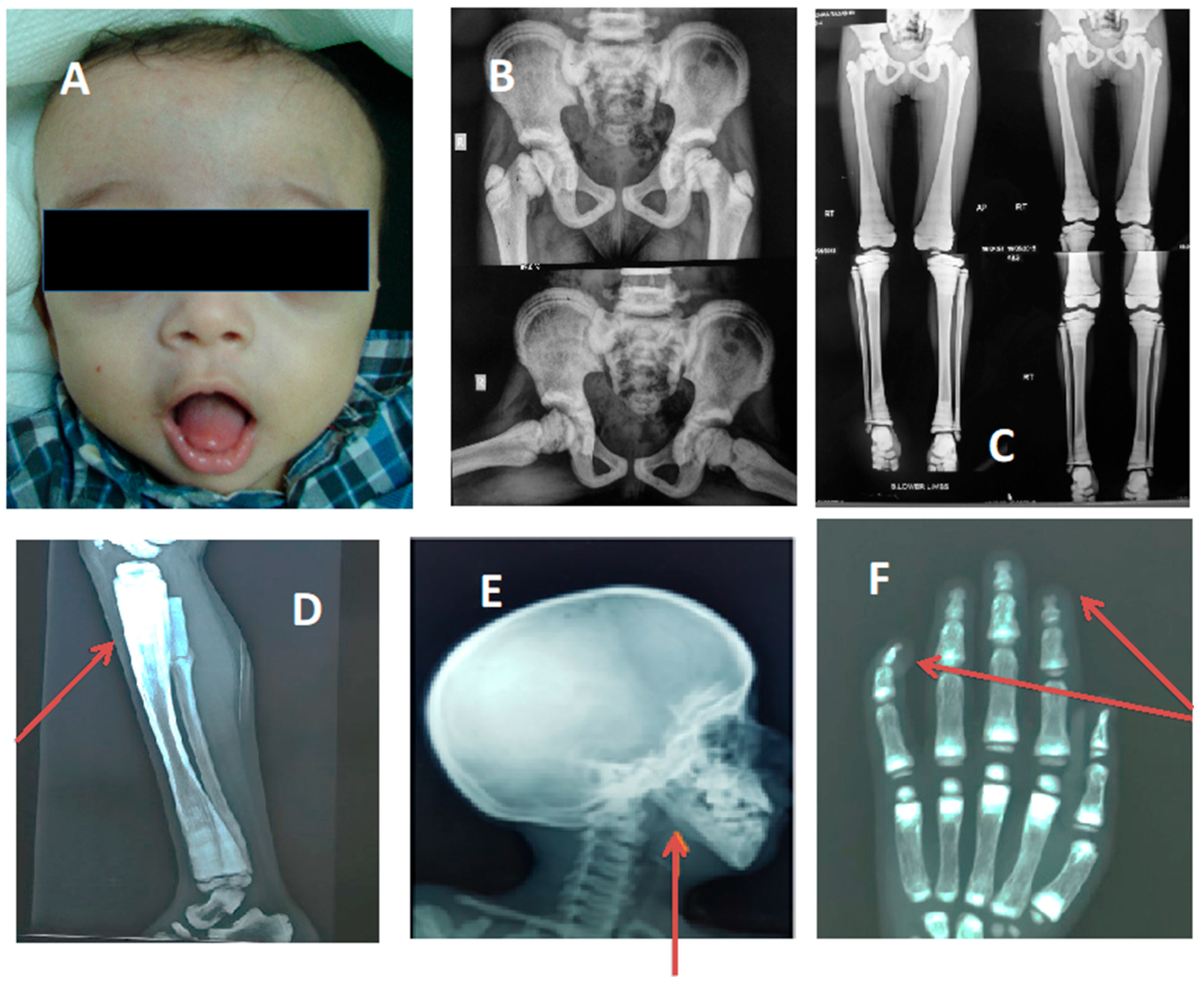 Genes 14 00900 g001 Genes 14 00900 g001