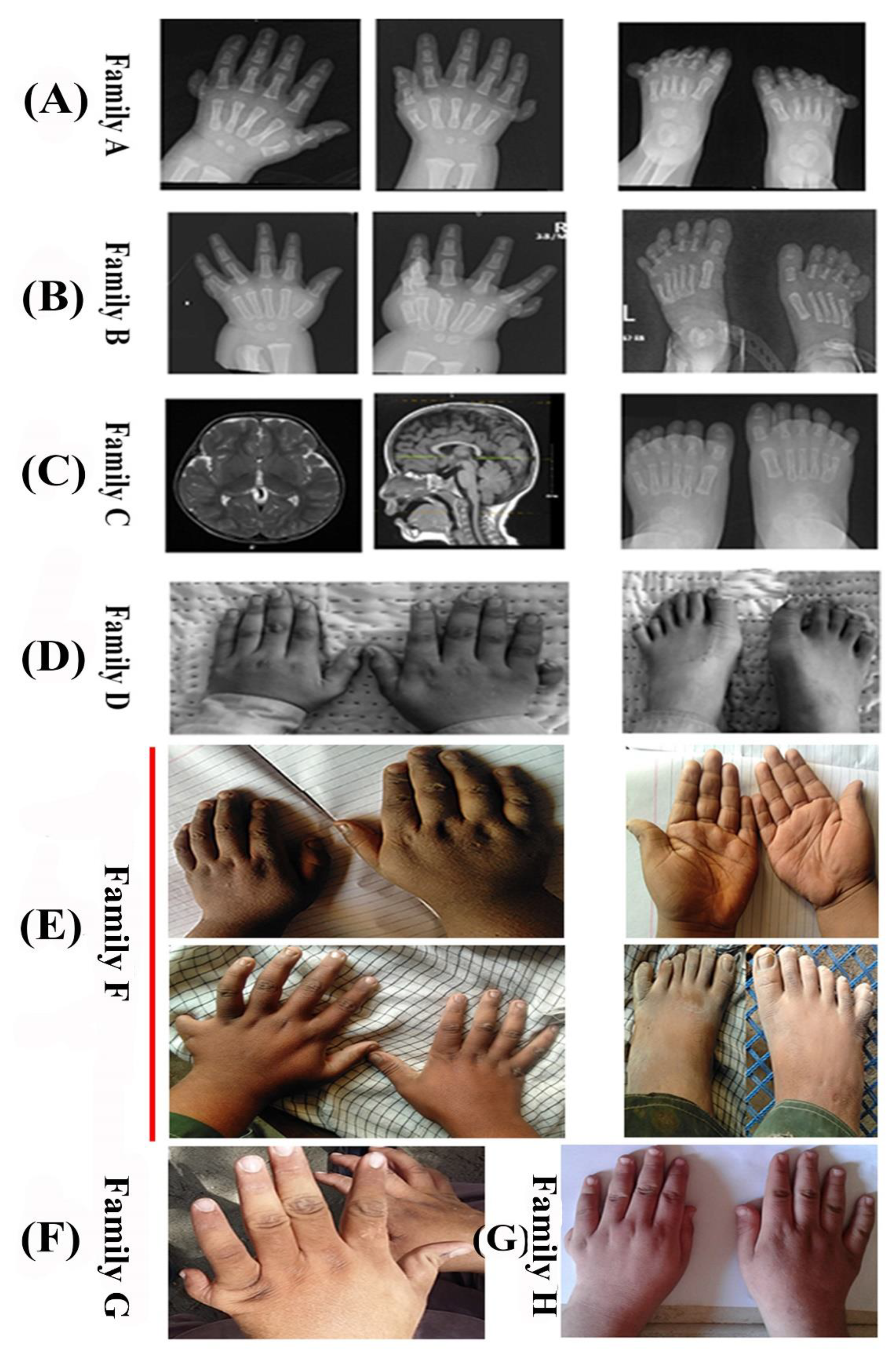 Genes 14 01113 g002 Genes 14 01113 g002