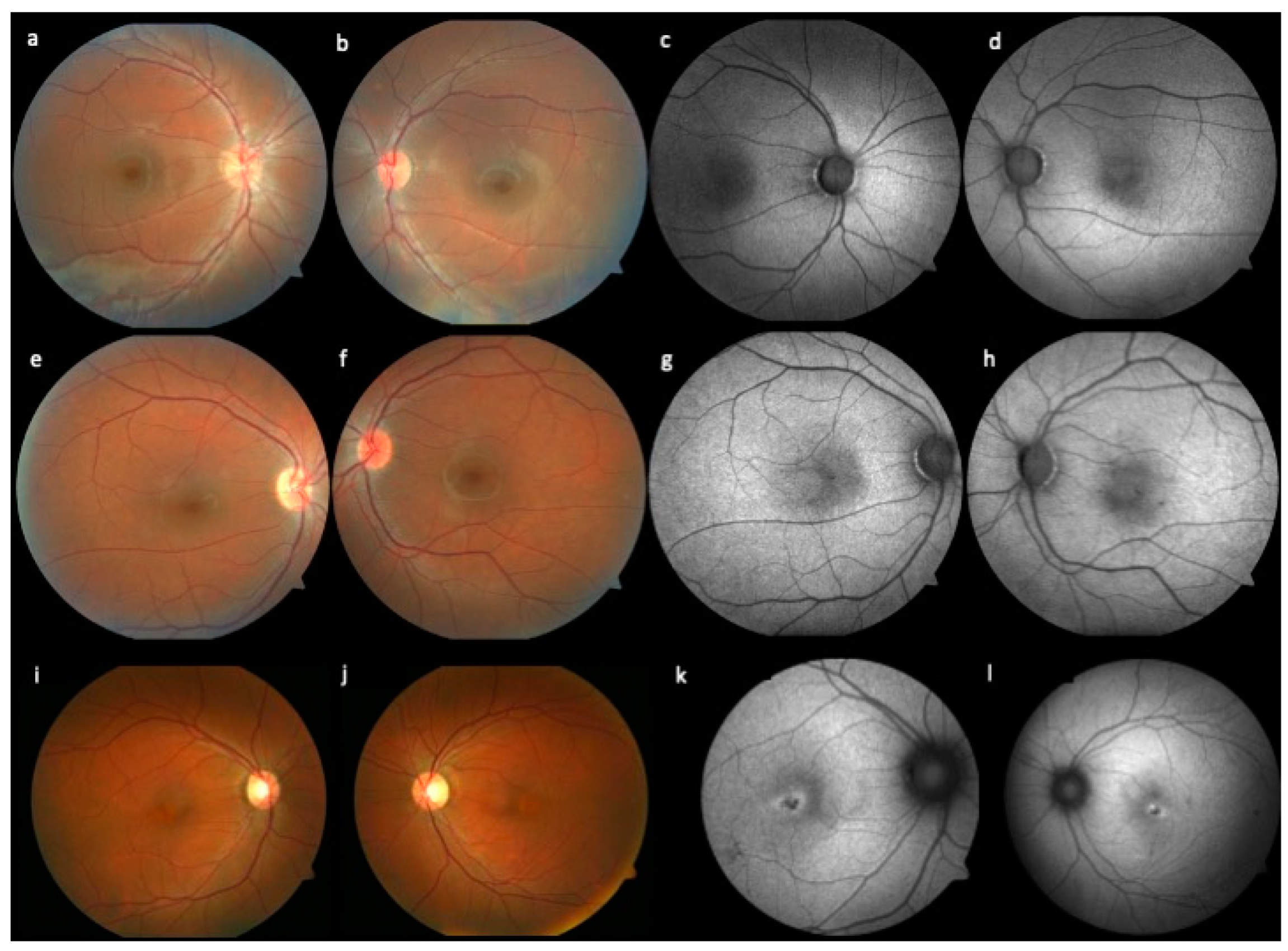 Genes 14 01296 g001 Genes 14 01296 g001