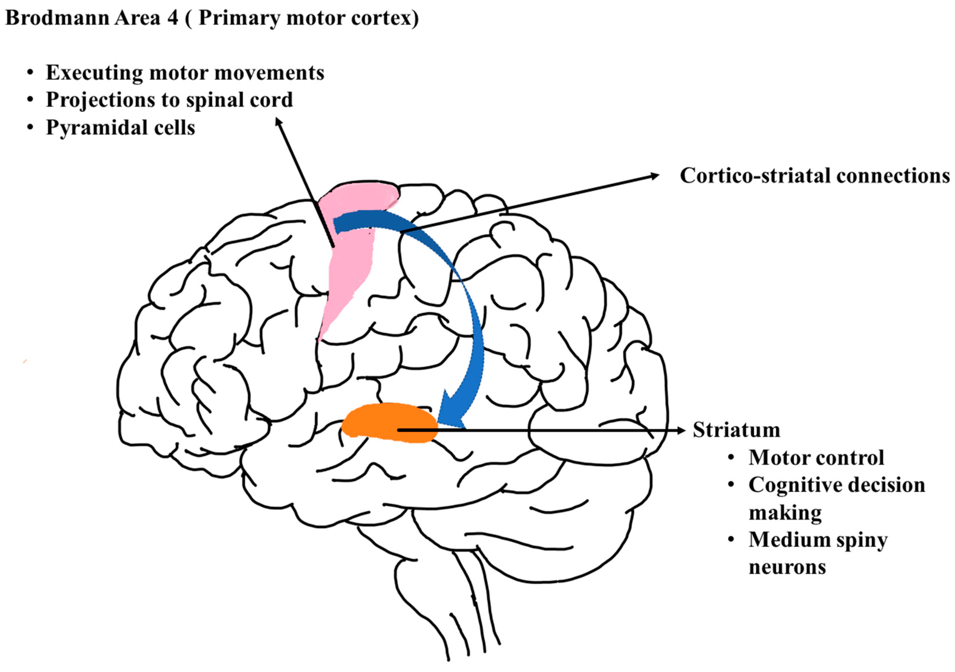 Nursing Paper Example on Huntington's Disease: Understanding a Devastating Neurological Disorder