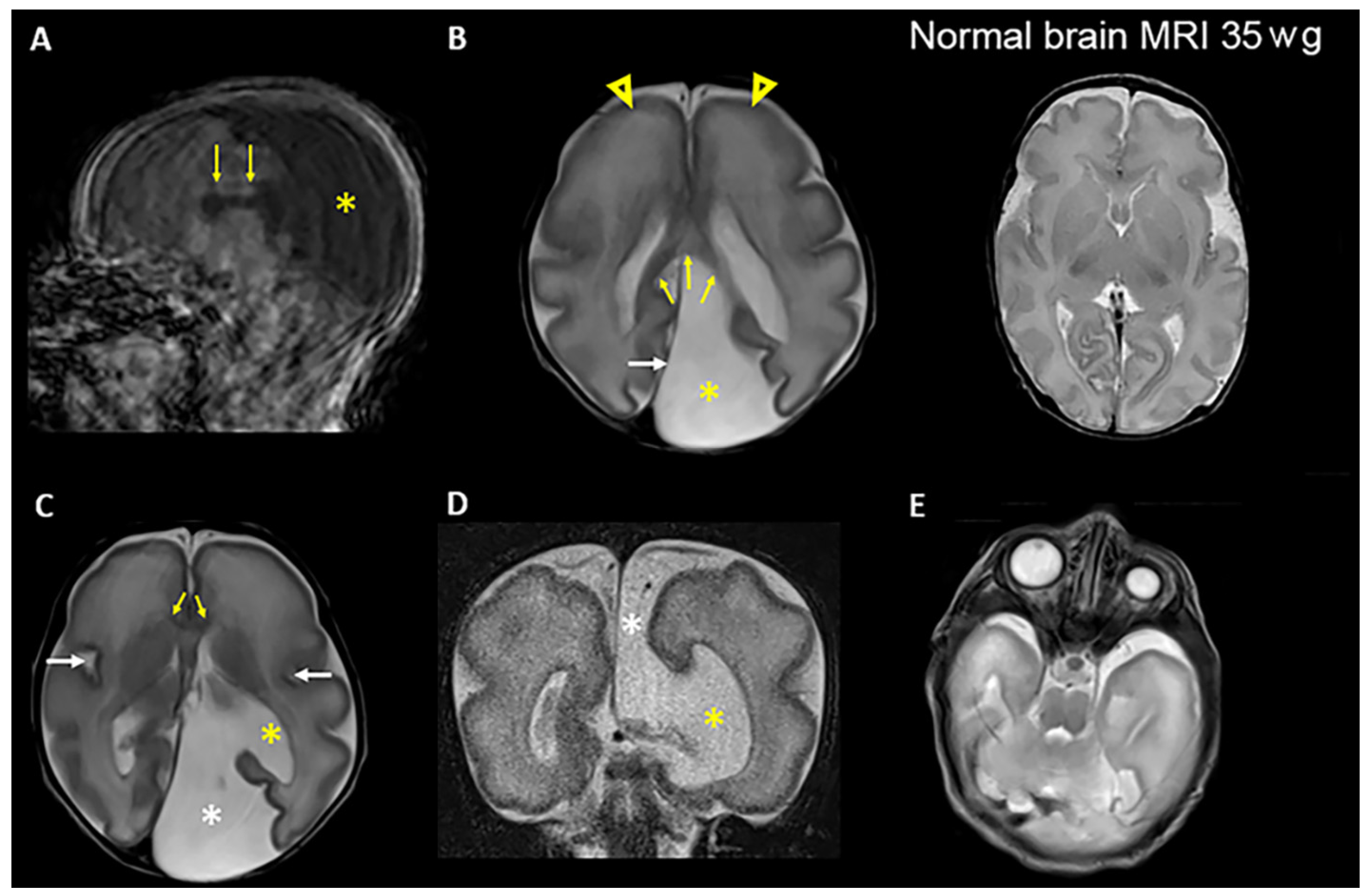 Genes 14 01985 g002 Genes 14 01985 g002