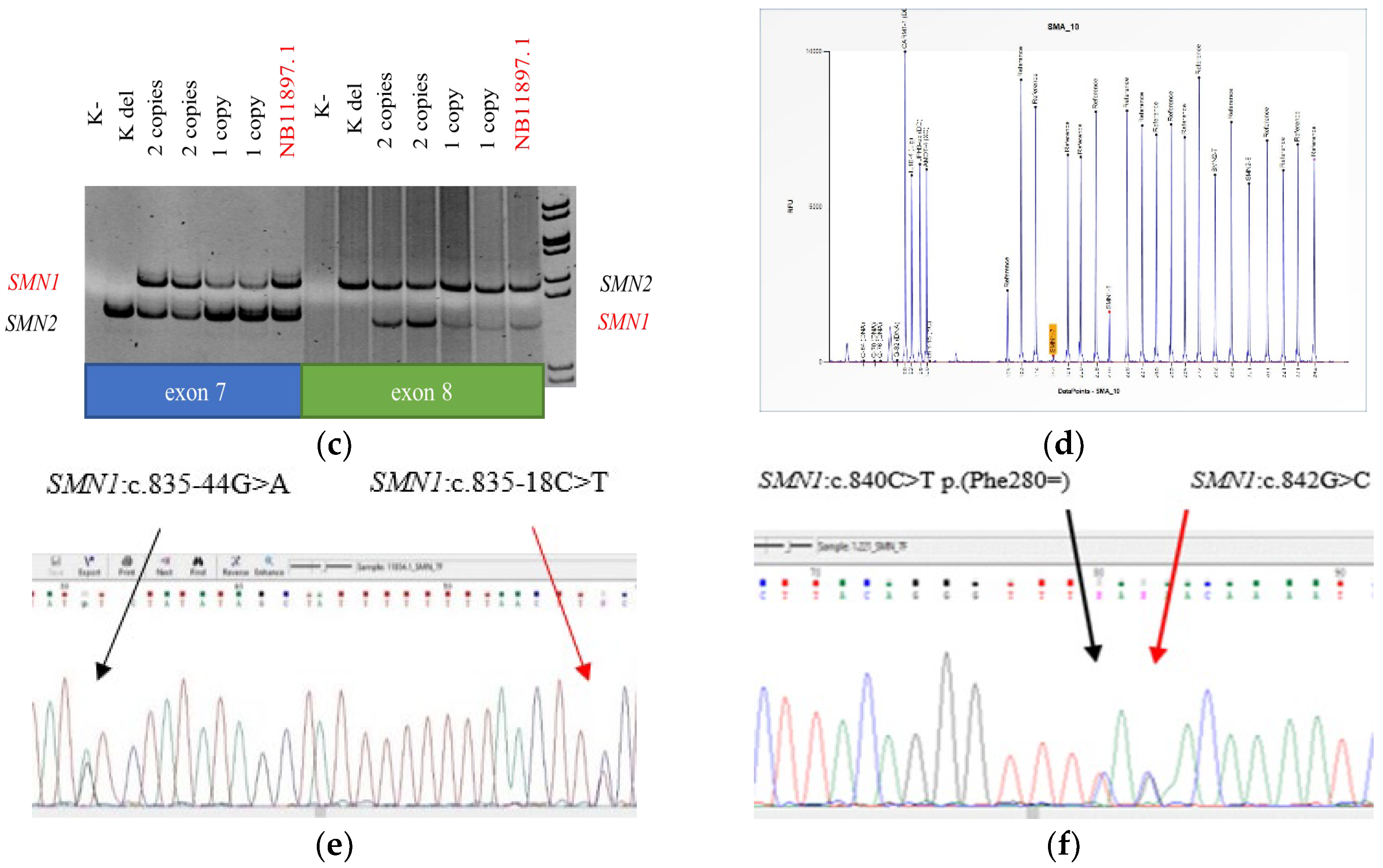 Genes 15 00956 g001b