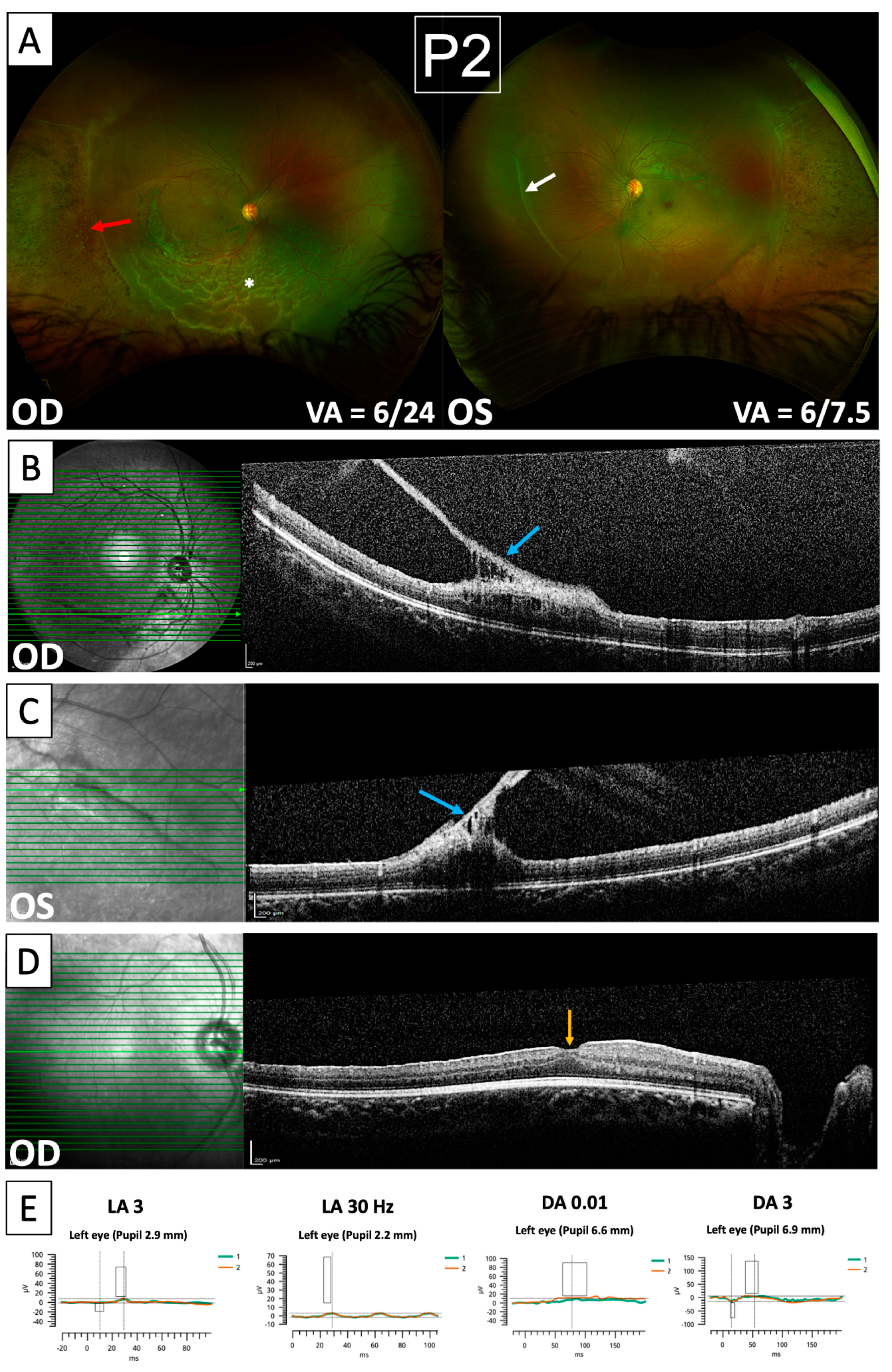 Genes 15 01178 g003