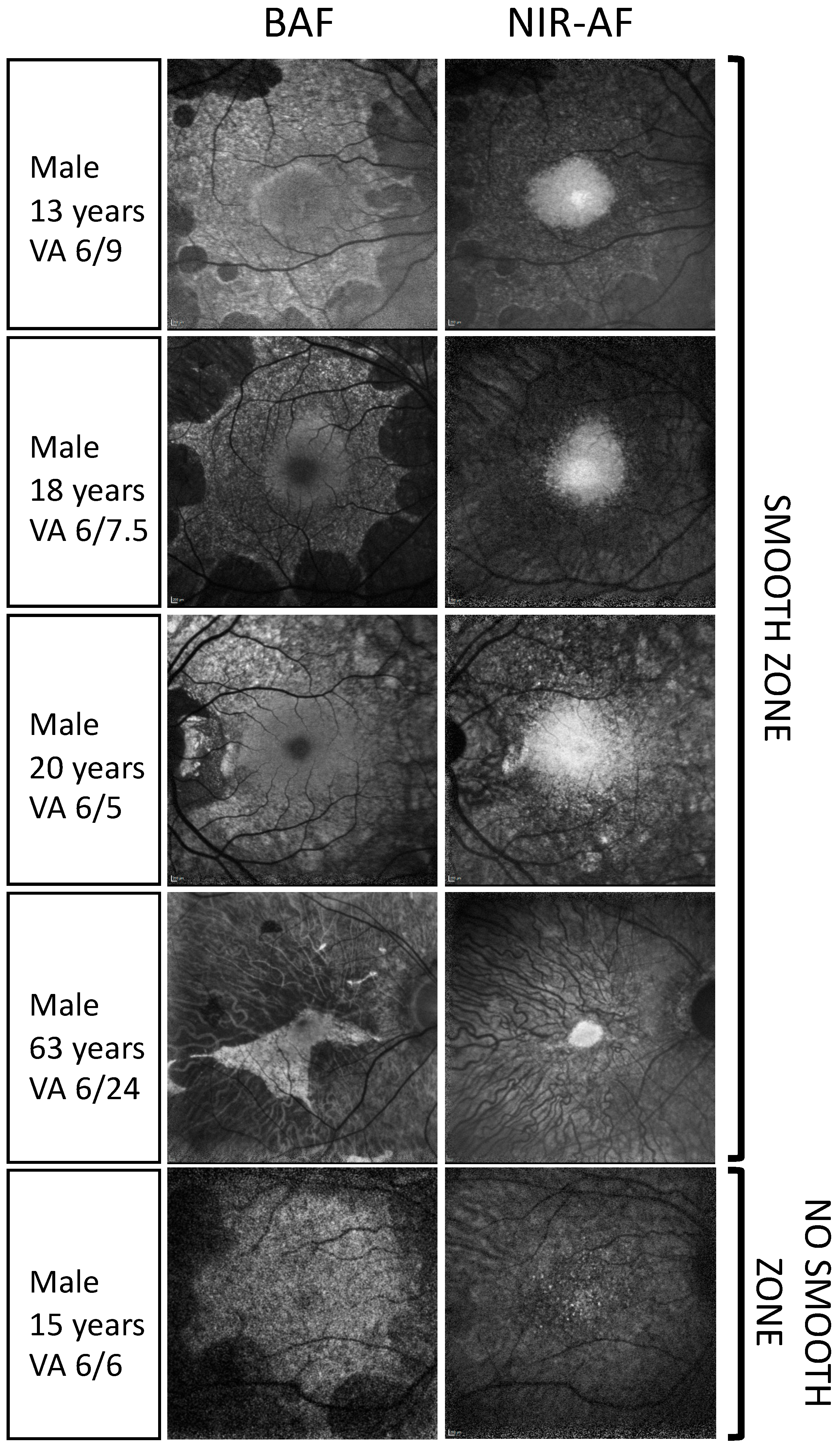 Genes 15 01471 g004