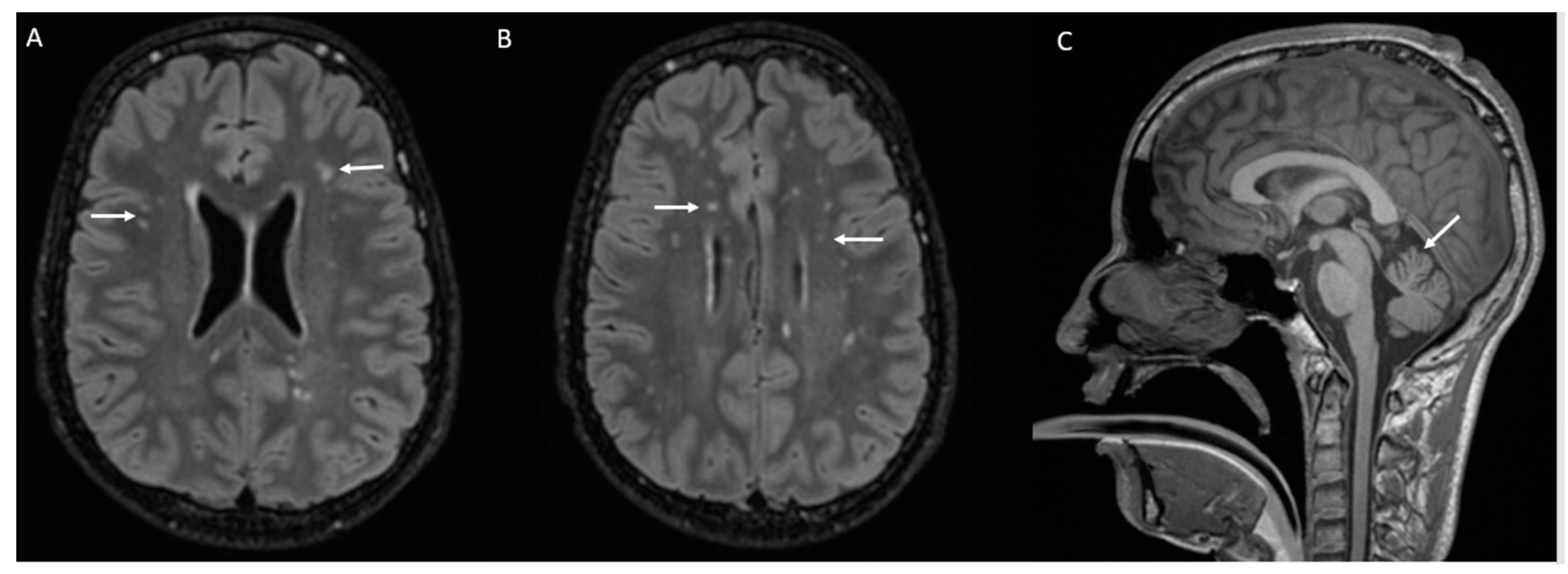 Genes 15 01508 g001