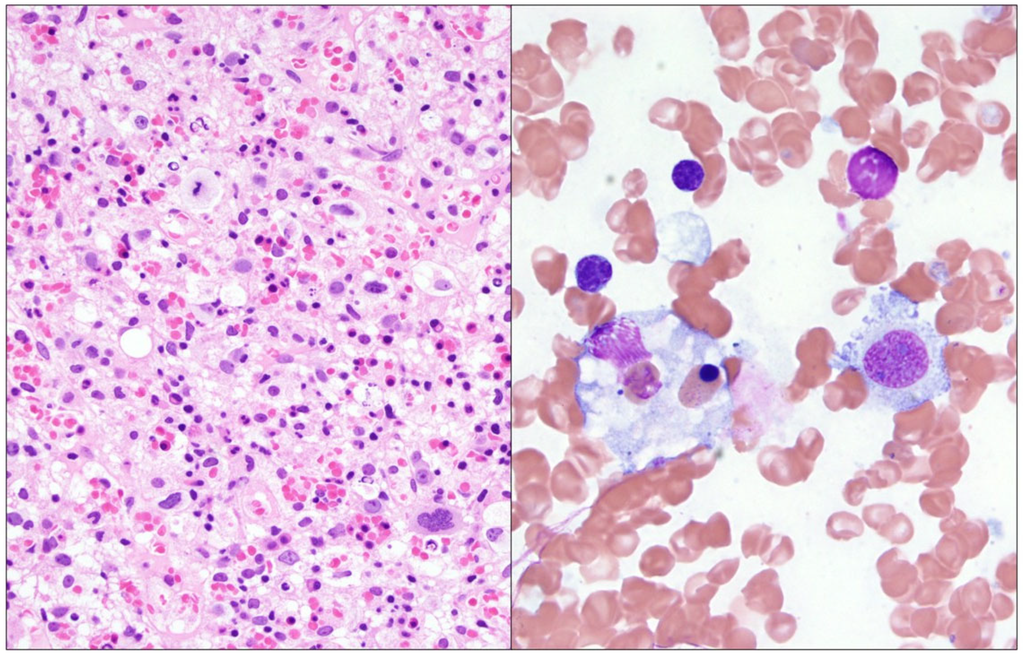 Genes 16 00382 g001