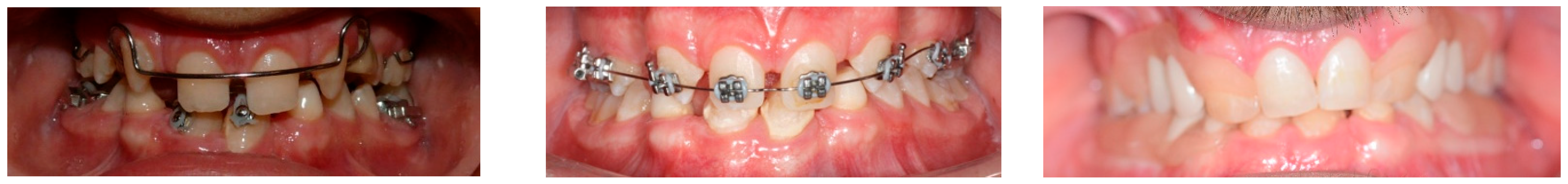 Genes 16 00582 g002 Genes 16 00582 g002