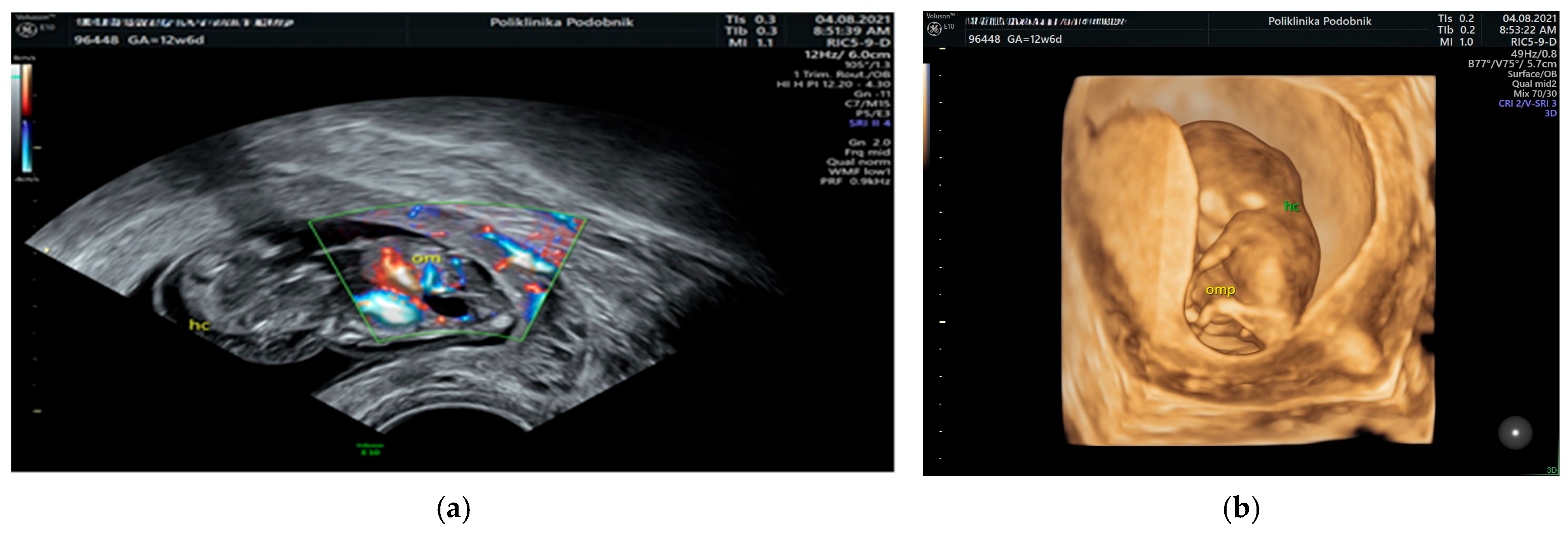Genes 16 00980 g003 Genes 16 00980 g003