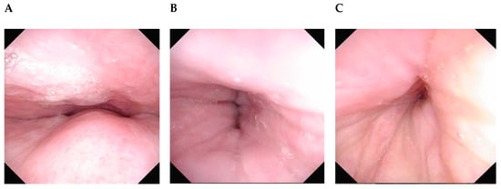 Healthcare Free Full Text Drug Induced Sleep Endoscopy Technique Indications Tips And Pitfalls Html