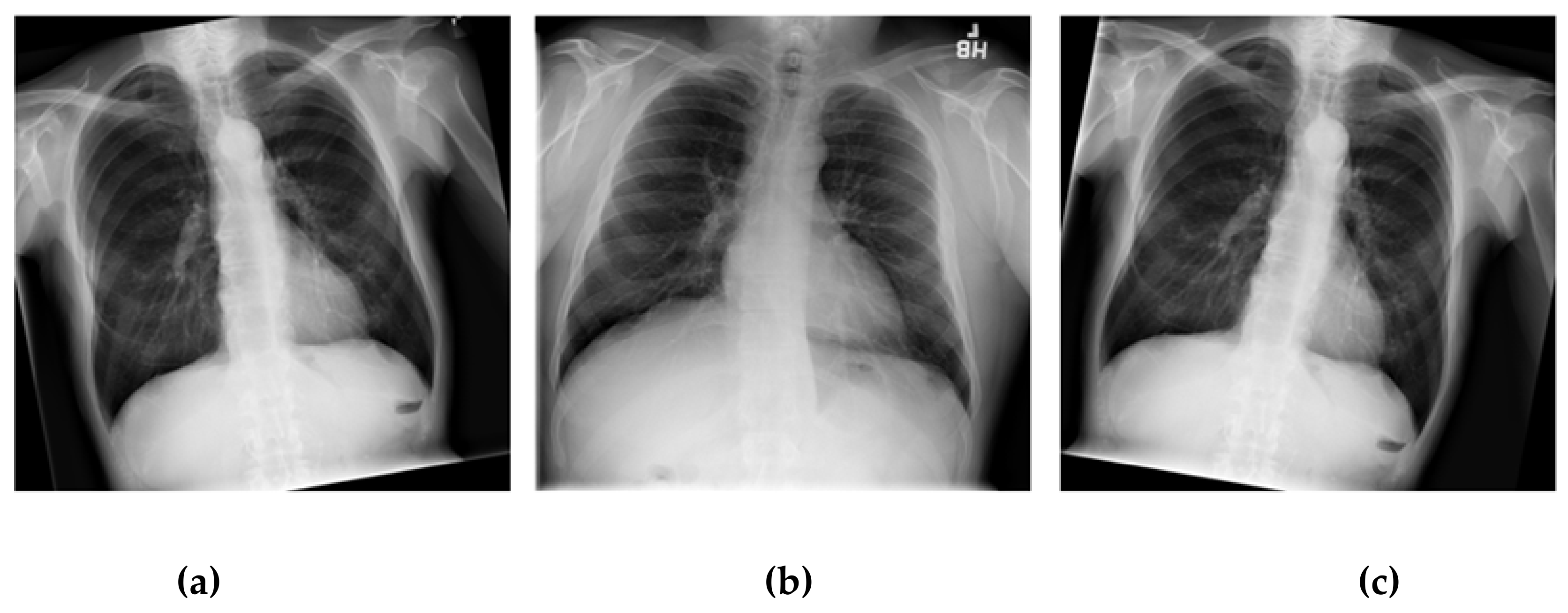 Healthcare Free Full Text Analyzing Lung Disease Using Highly Effective Deep Learning Techniques Html