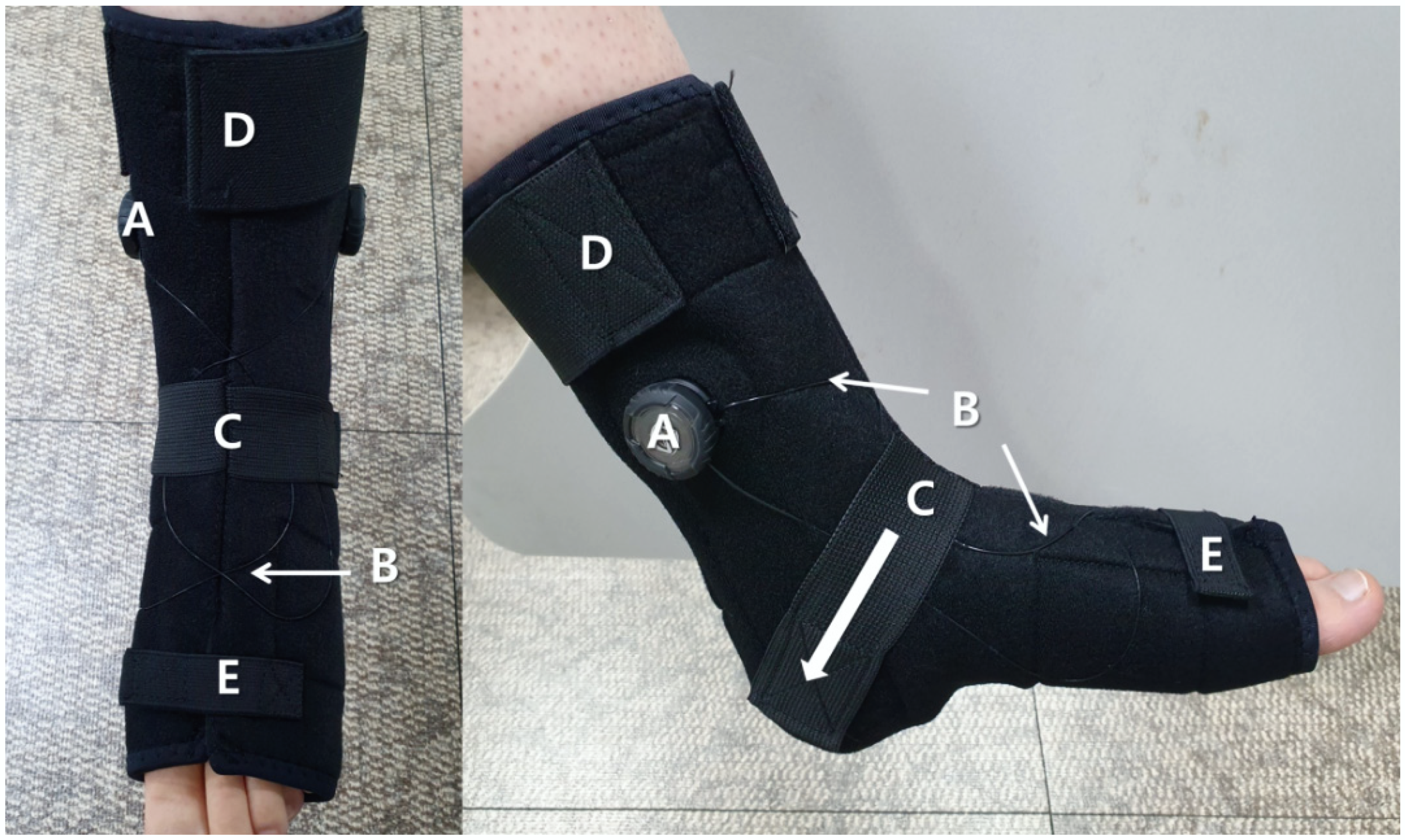 Healthcare | Free Full-Text | Immediate Effects of Ankle–Foot Orthosis  Using Wire on Static Balance of Patients with Stroke with Foot Drop: A  Cross-Over Study