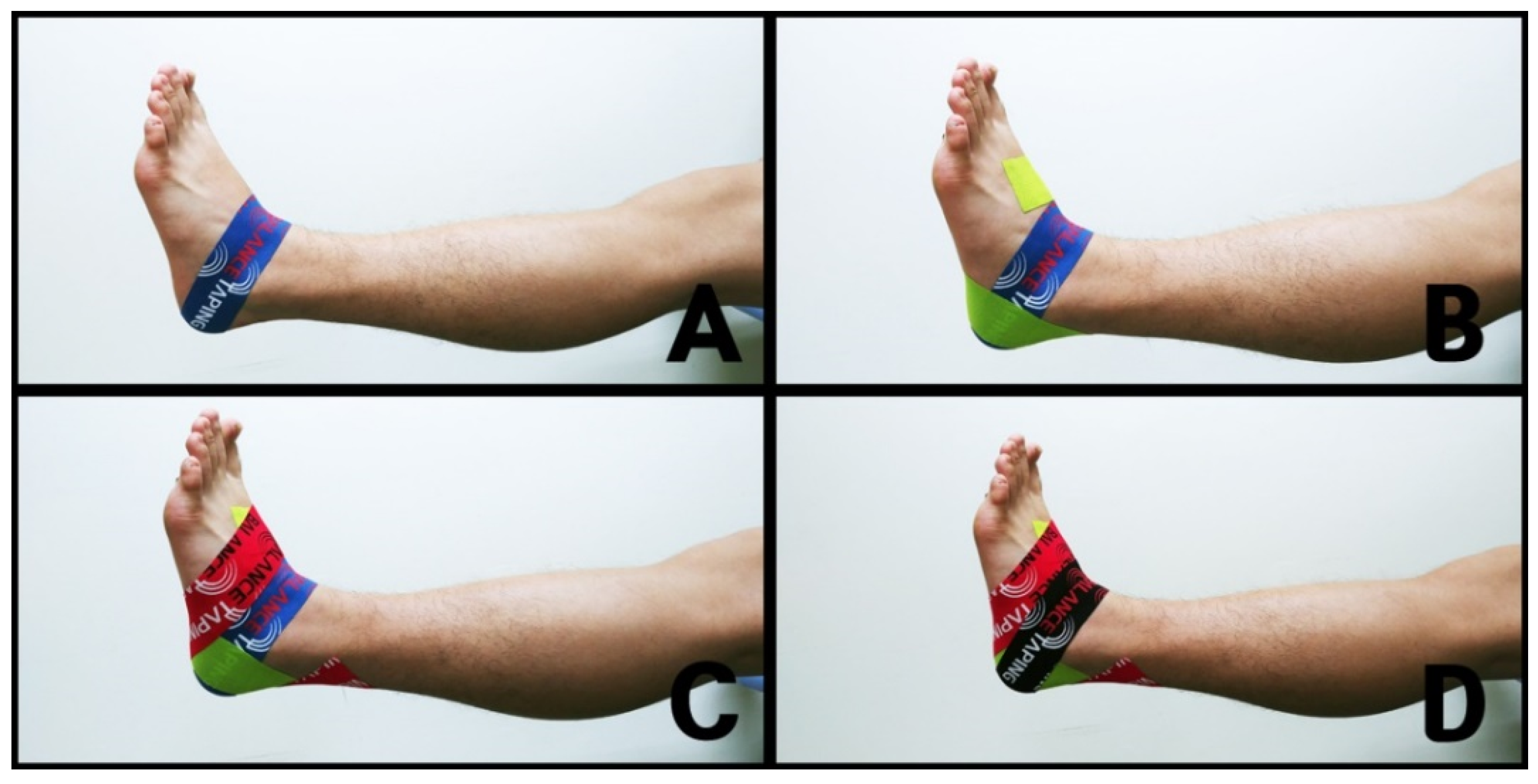 Healthcare | Free Full-Text | Immediate Effect of Balance Taping Using Kinesiology  Tape on Dynamic and Static Balance after Ankle Muscle Fatigue