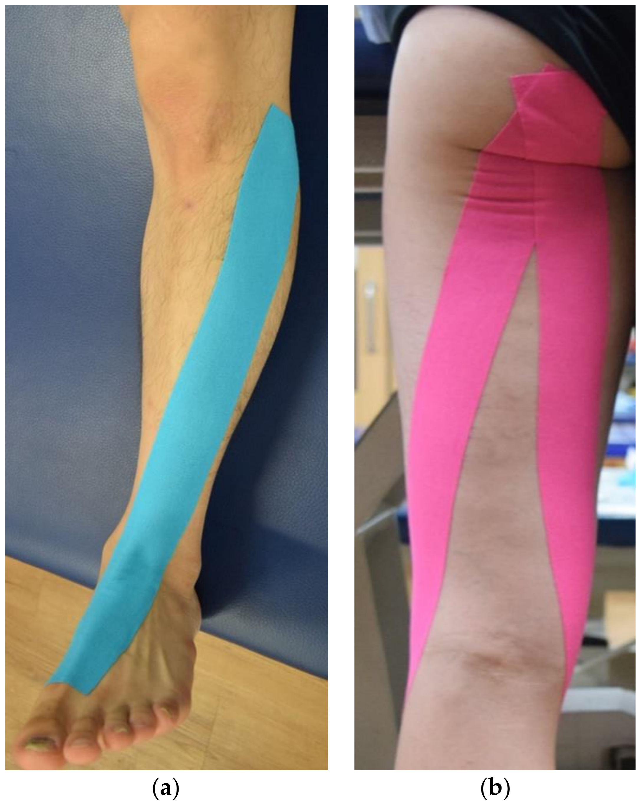 Healthcare | Free Full-Text | Short-Term Effect of Kinesio Taping of  Lower-Leg Proprioceptive Neuromuscular Facilitation Pattern on Gait  Parameter and Dynamic Balance in Chronic Stroke with Foot Drop