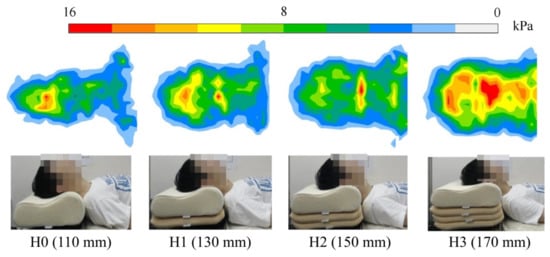 https://www.mdpi.com/healthcare/healthcare-09-01333/article_deploy/html/images/healthcare-09-01333-g004-550.jpg