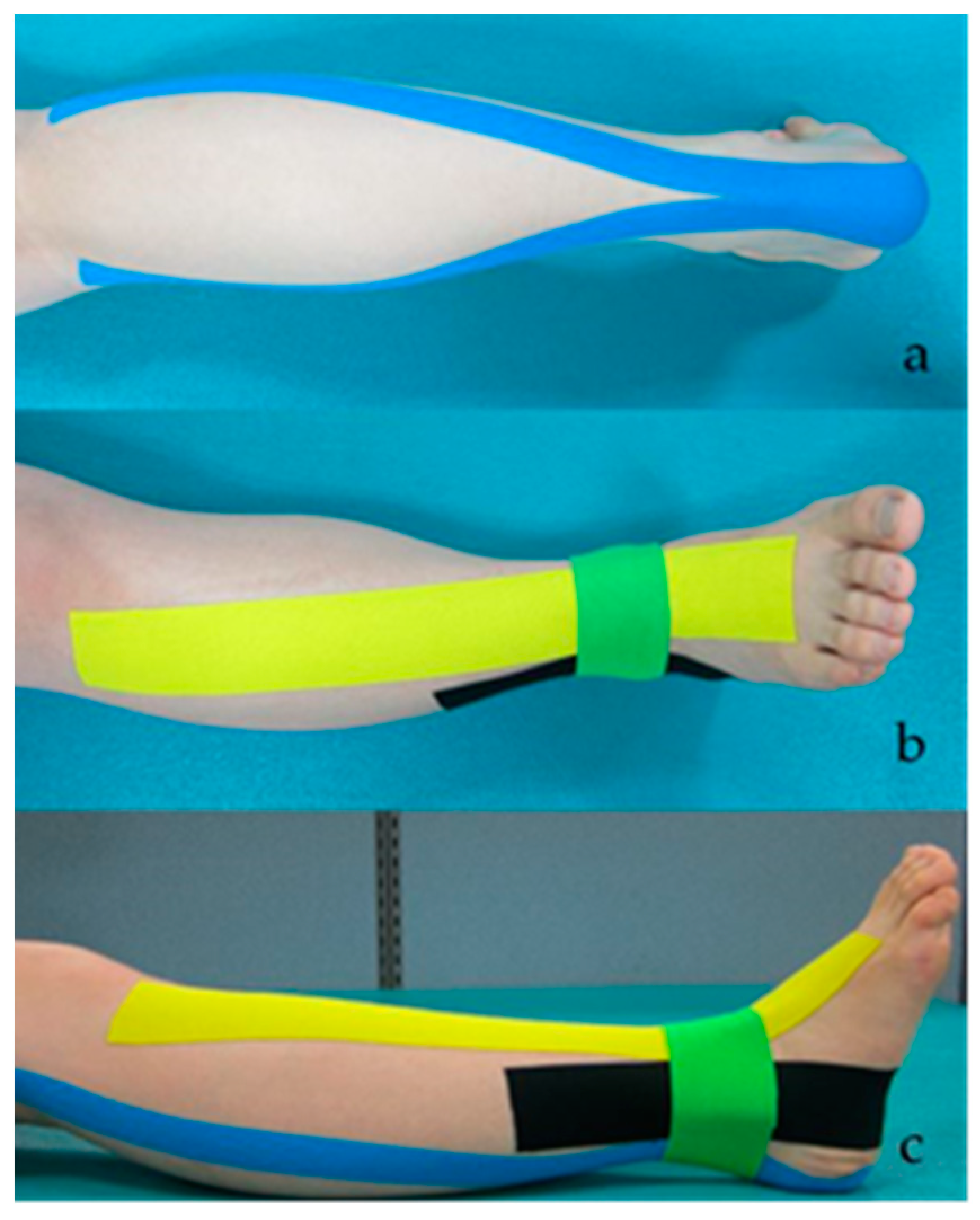 Healthcare | Free Full-Text | Proprioceptive Neuromuscular Facilitation  Kinesio Taping Improves Range of Motion of Ankle Dorsiflexion and Balance  Ability in Chronic Stroke Patients