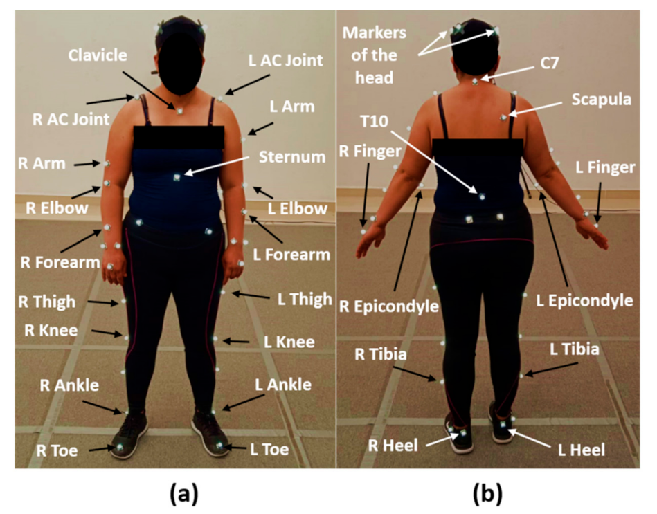 Healthcare | Free Full-Text | Differences in the Glenohumeral Joint before  and after Unilateral Breast Cancer Surgery: Motion Capture Analysis