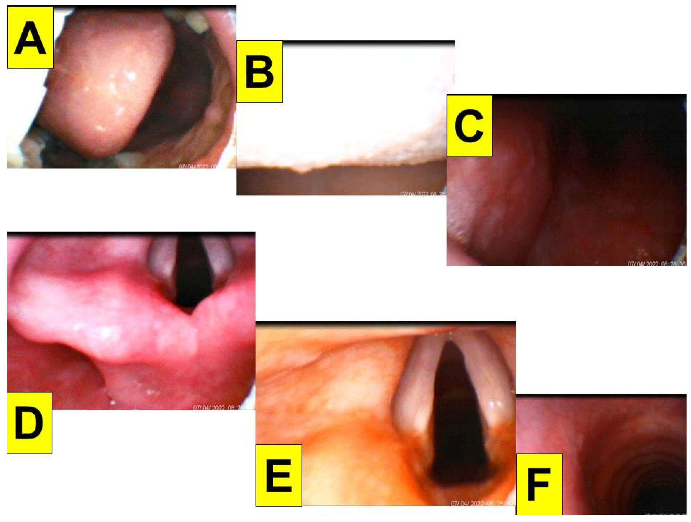 Healthcare 10 01105 g004