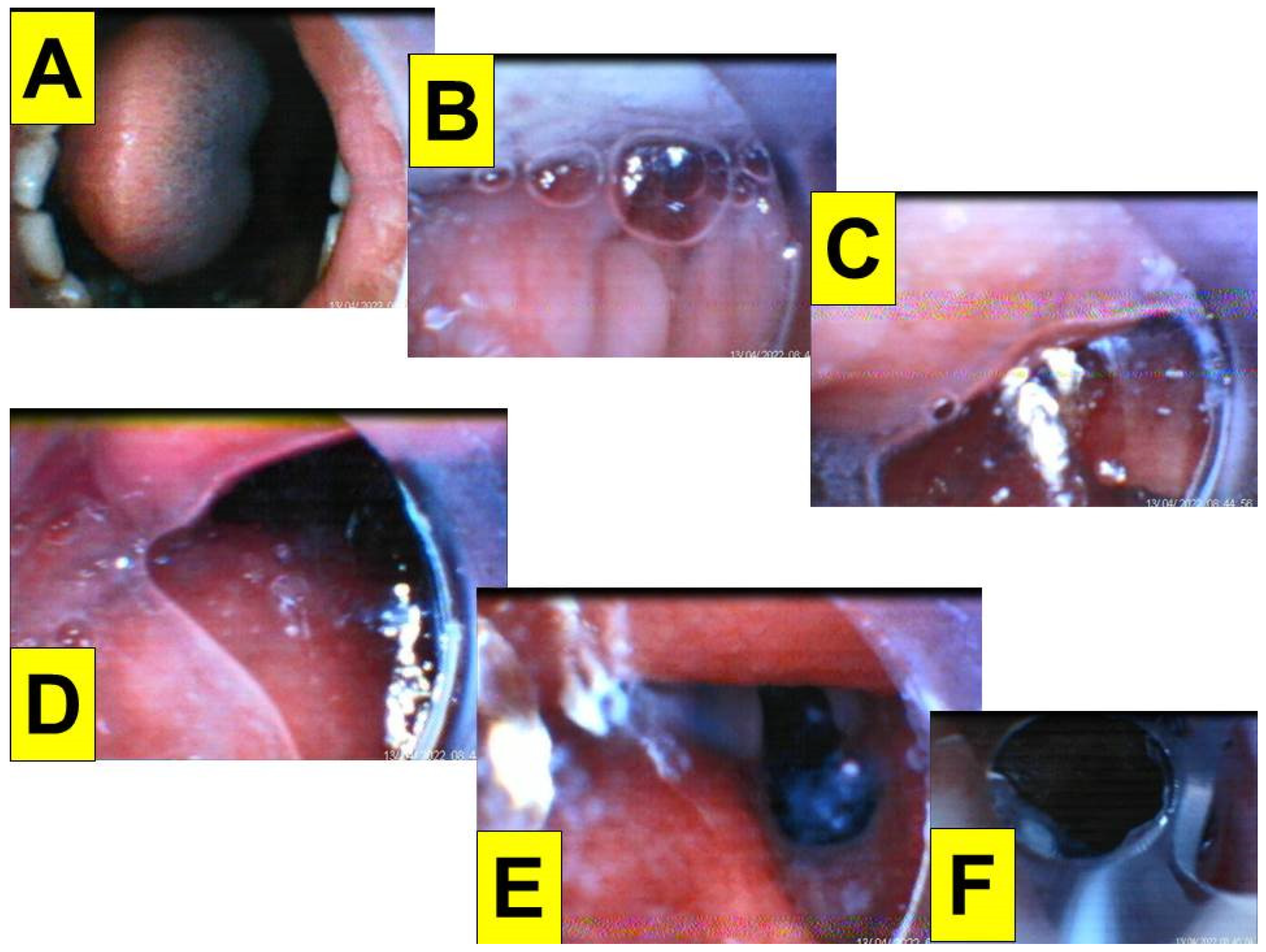 Healthcare 10 01105 g005
