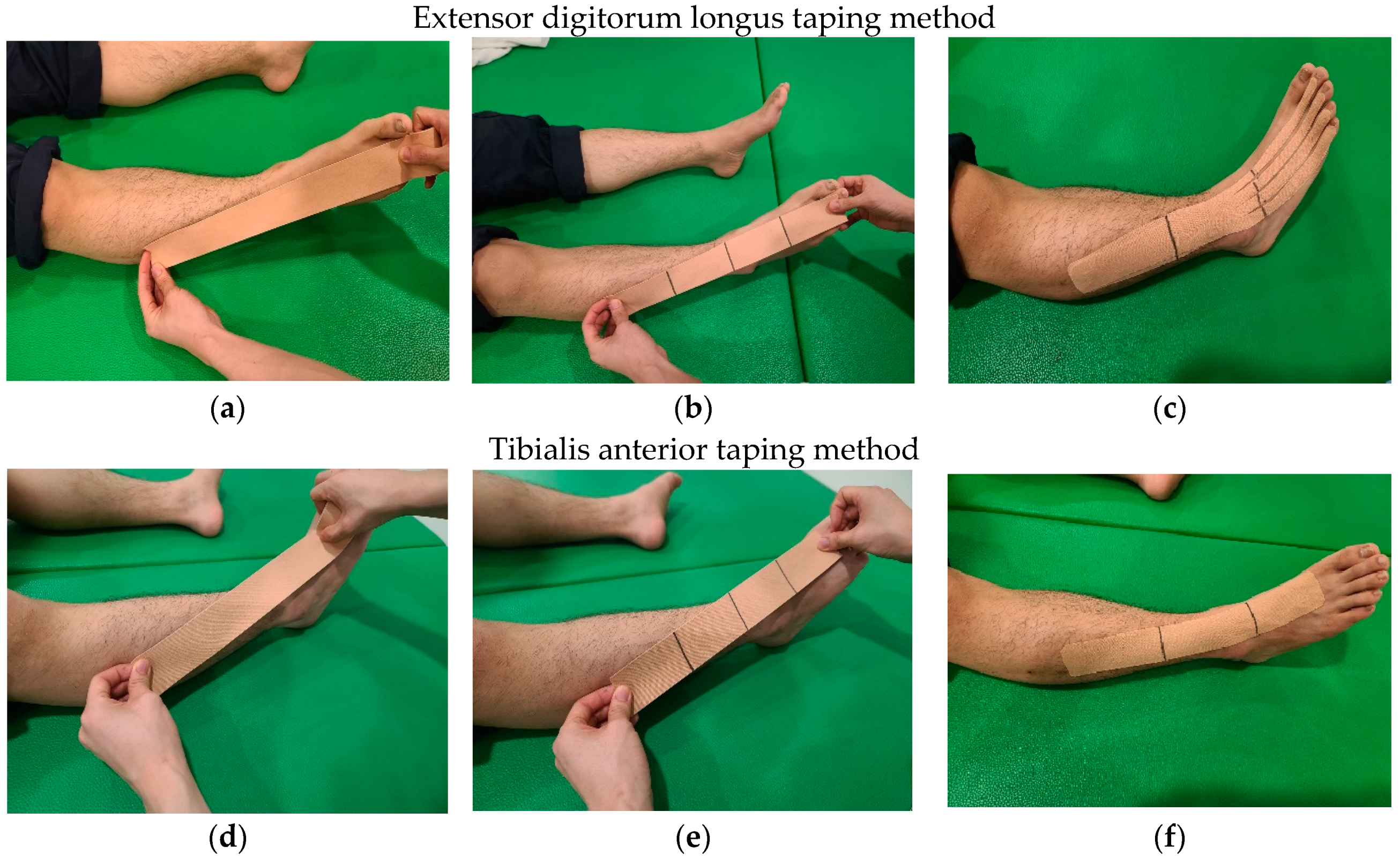 Healthcare | Free Full-Text | Effects of Extensor Digitorum Longus and  Tibialis Anterior Taping on Balance and Gait Performance in Patients Post  Stroke