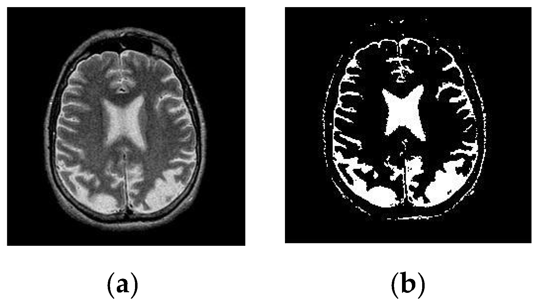 Healthcare | Free Full-Text | Cancerous And Non-Cancerous Brain MRI ...