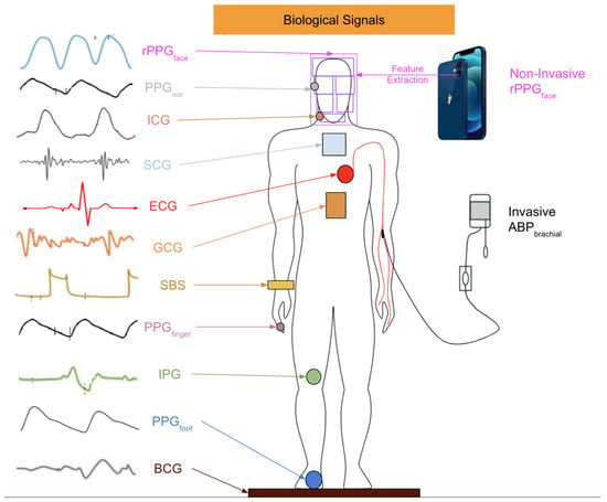 Cuffless Blood Pressure Monitors: Principles, Standards and Approval for  Medical Use