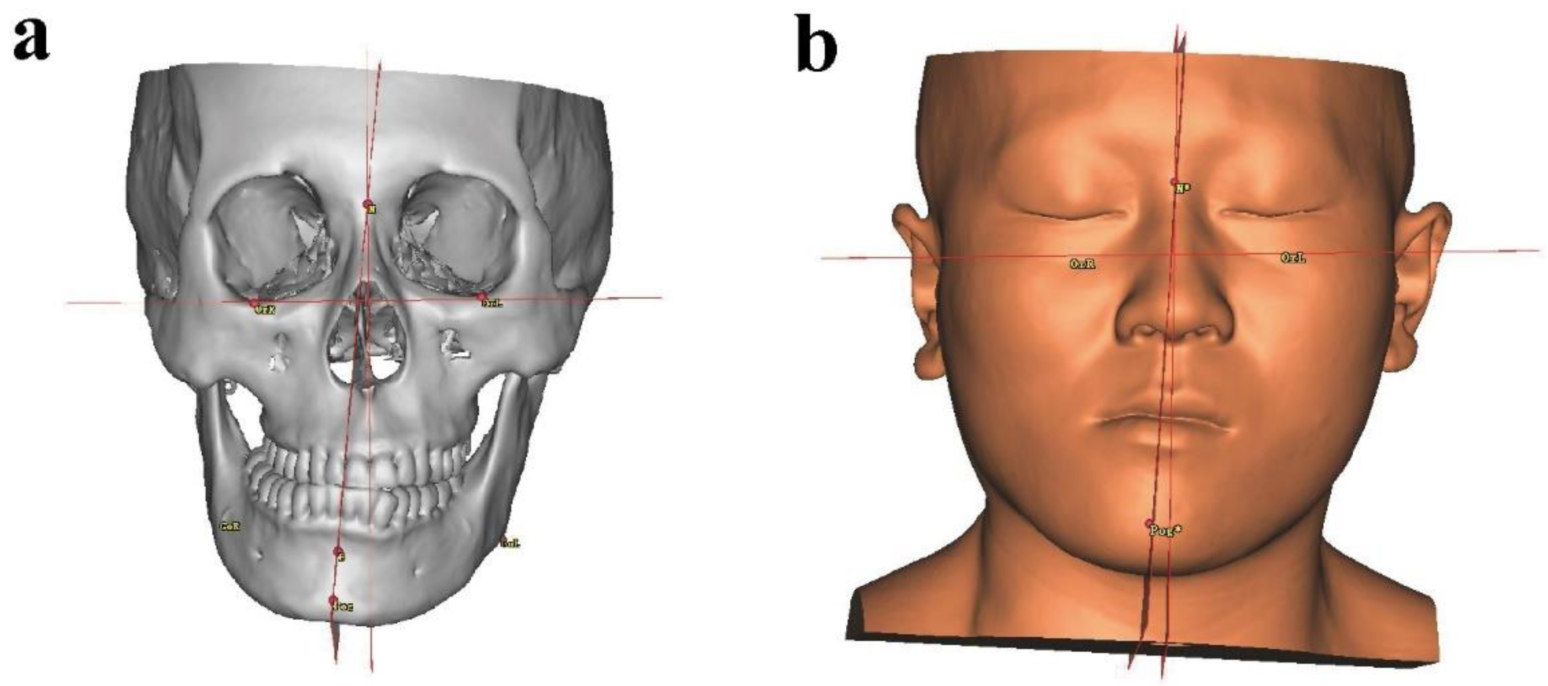 Healthcare | Free Full-Text | Clinical Application of Individualized 3D ...