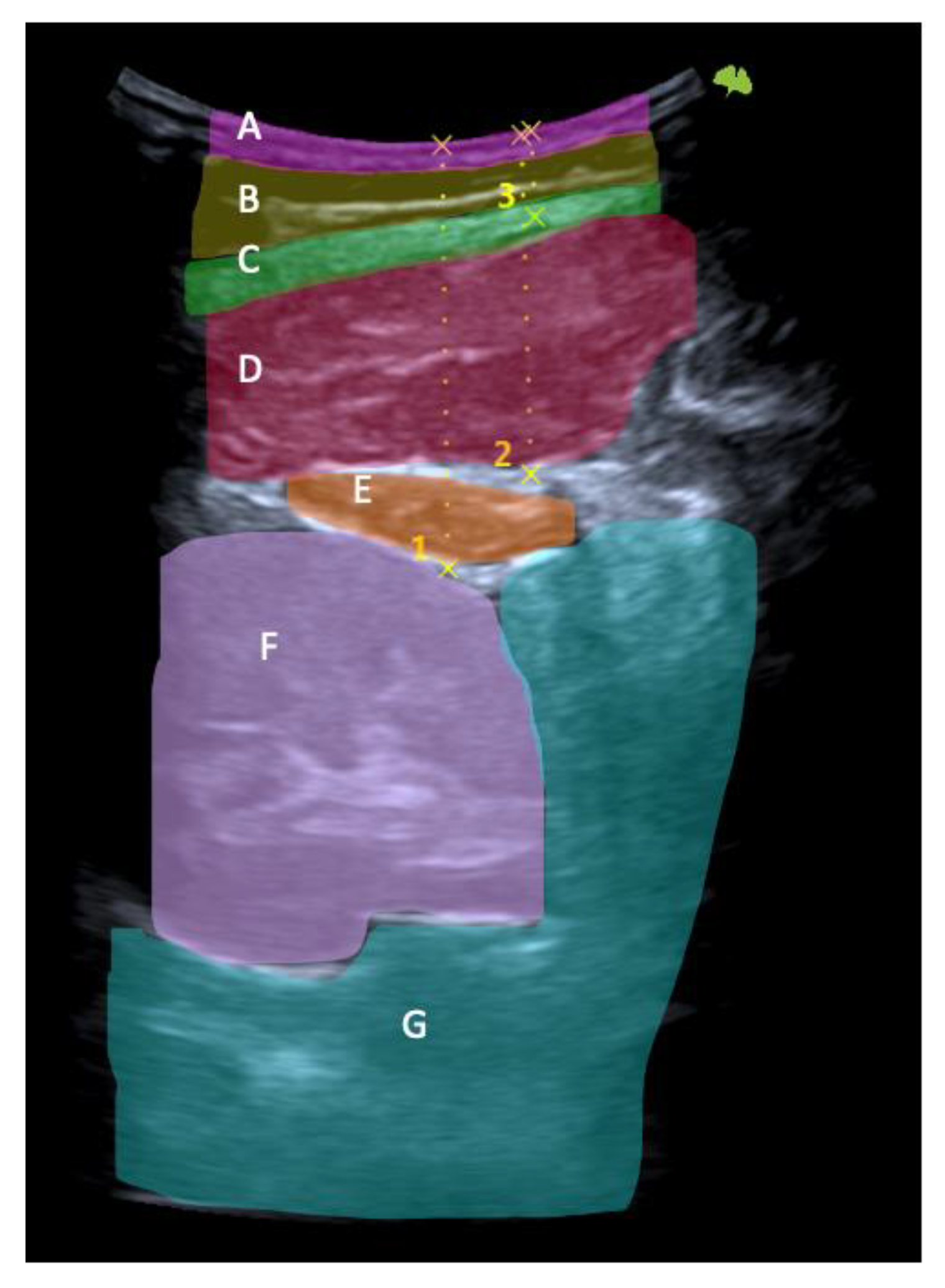 Healthcare | Free Full-Text | Correlation between Anthropometric