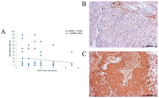 Immunohistochemistry analysis of VEGF-A 165 b expression in heart